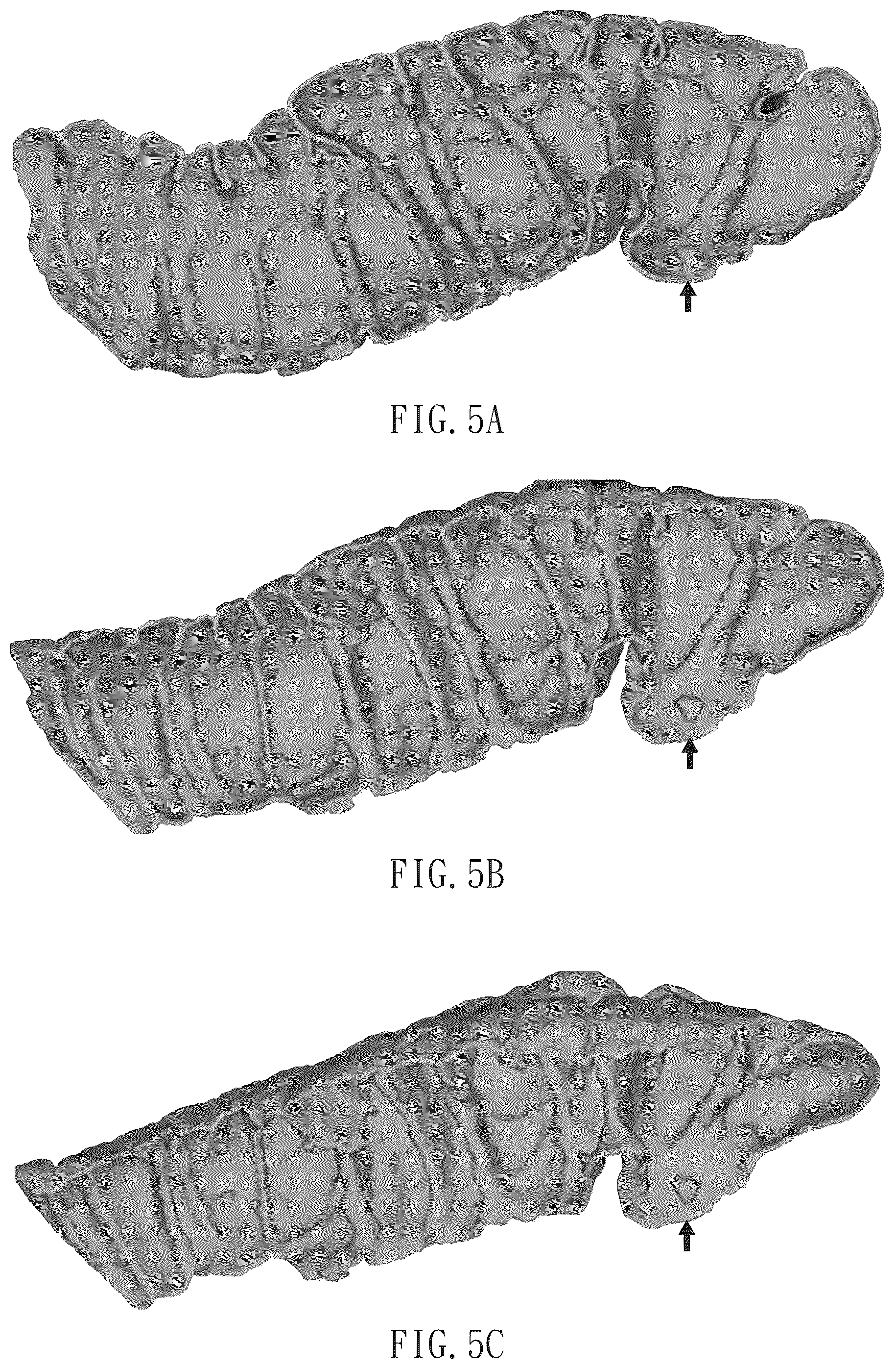 Patent US12322057 Figure 5 – Method for direct manipulation and visualization of the 3D internal structures of a tubular object as they are in reality without any noticeable distortion