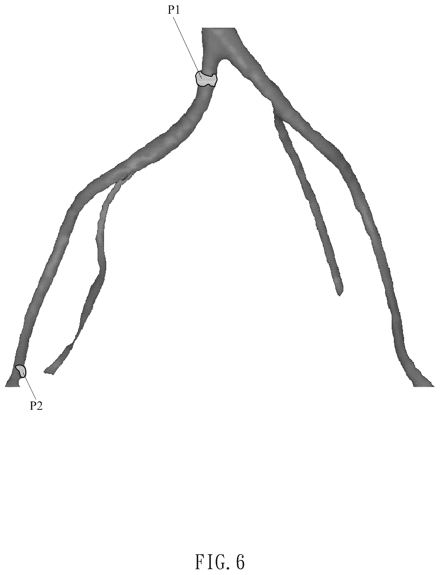 Patent US12322057 Figure 6 – Method for direct manipulation and visualization of the 3D internal structures of a tubular object as they are in reality without any noticeable distortion
