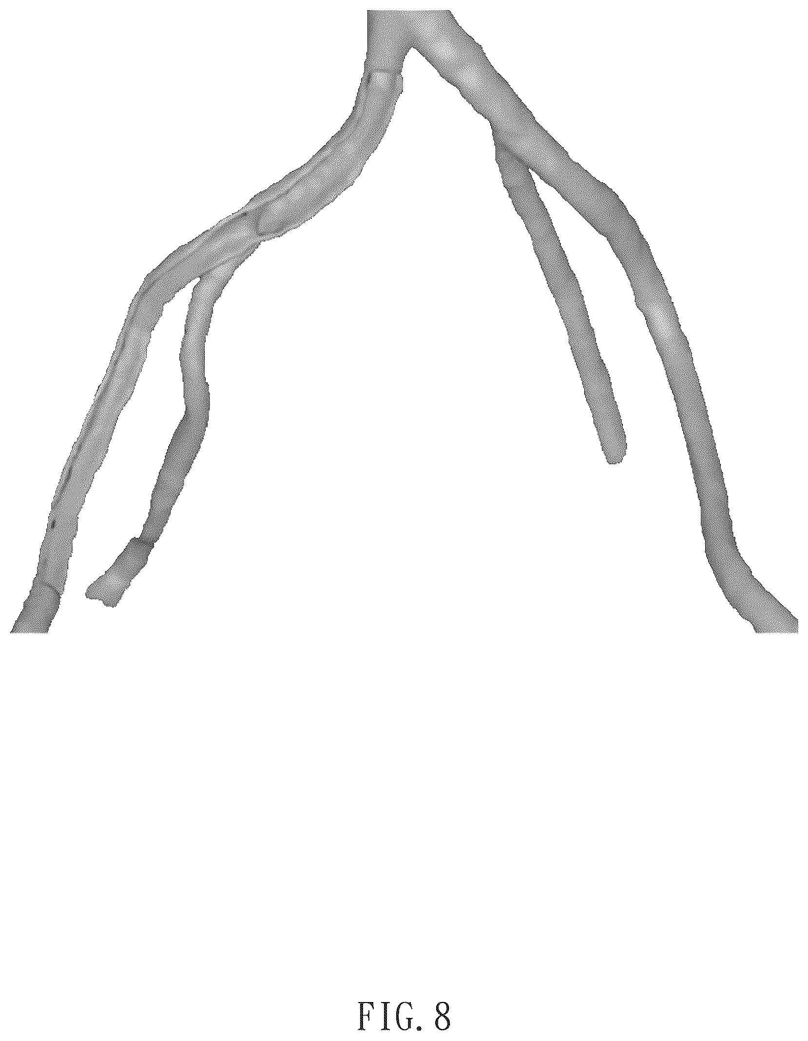 Patent US12322057 Figure 8 – Method for direct manipulation and visualization of the 3D internal structures of a tubular object as they are in reality without any noticeable distortion