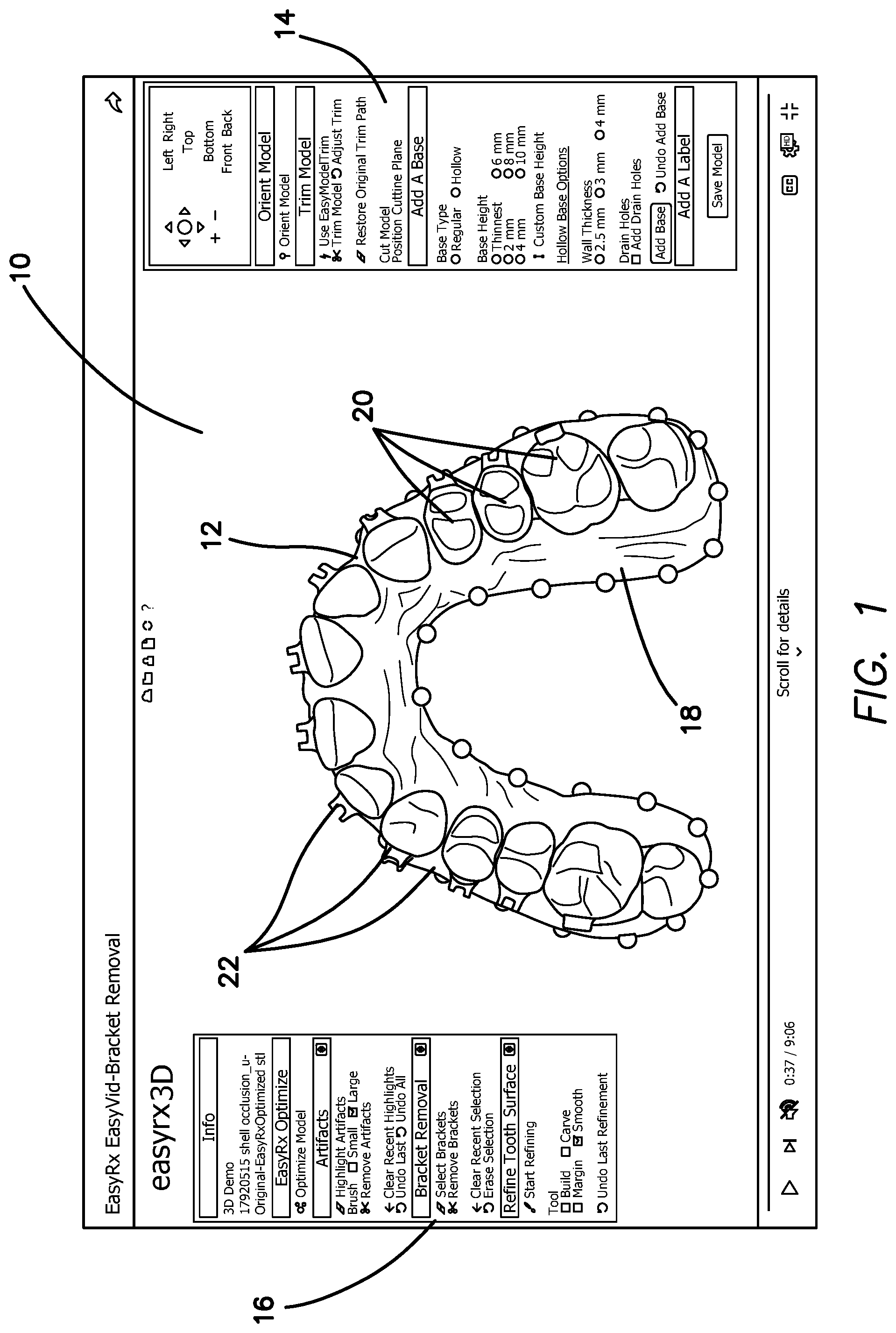 Patent US12322059 Figure 1 – System and method for removing brackets from customized orthodontic appliances and products