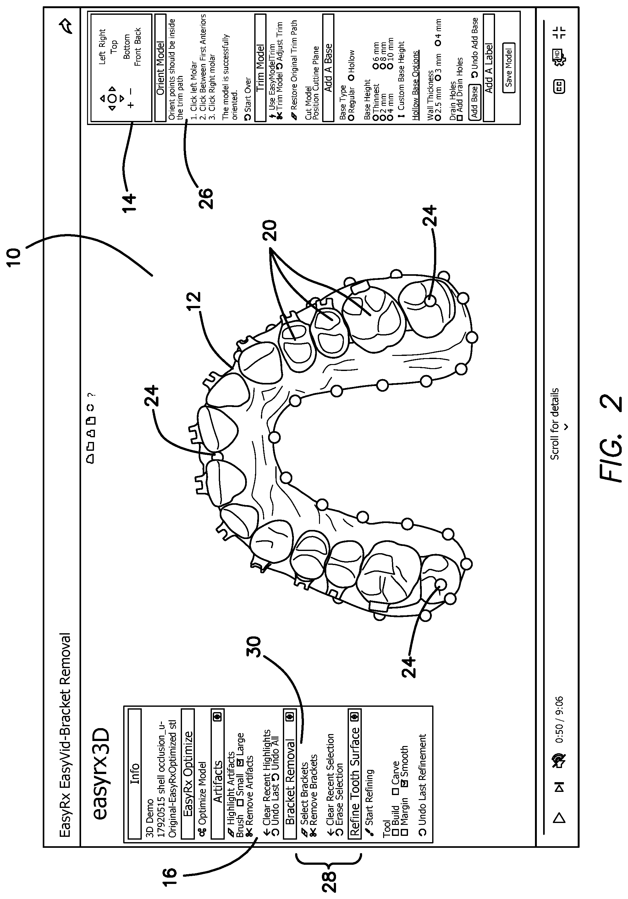 Patent US12322059 Figure 2 – System and method for removing brackets from customized orthodontic appliances and products