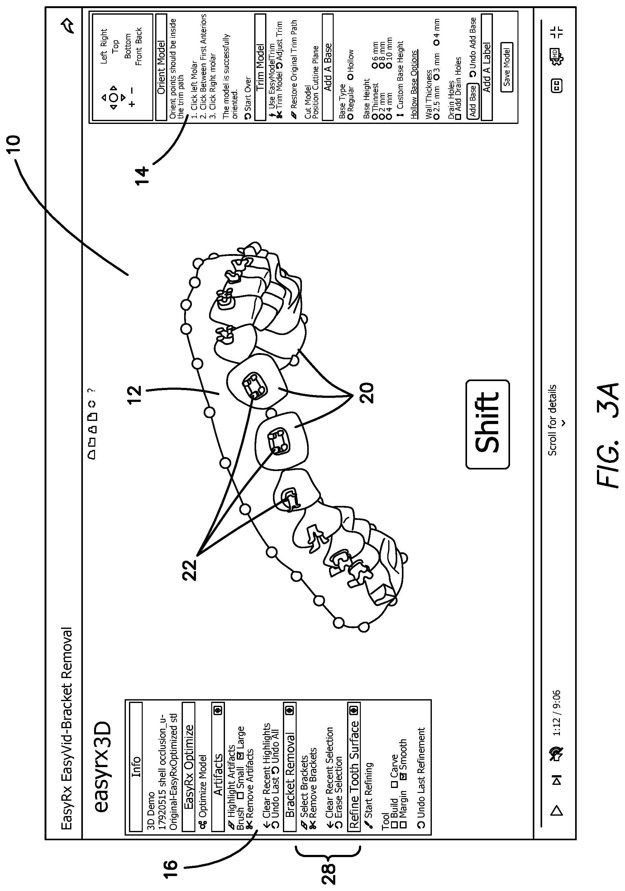 Patent US12322059 Figure 3 – System and method for removing brackets from customized orthodontic appliances and products