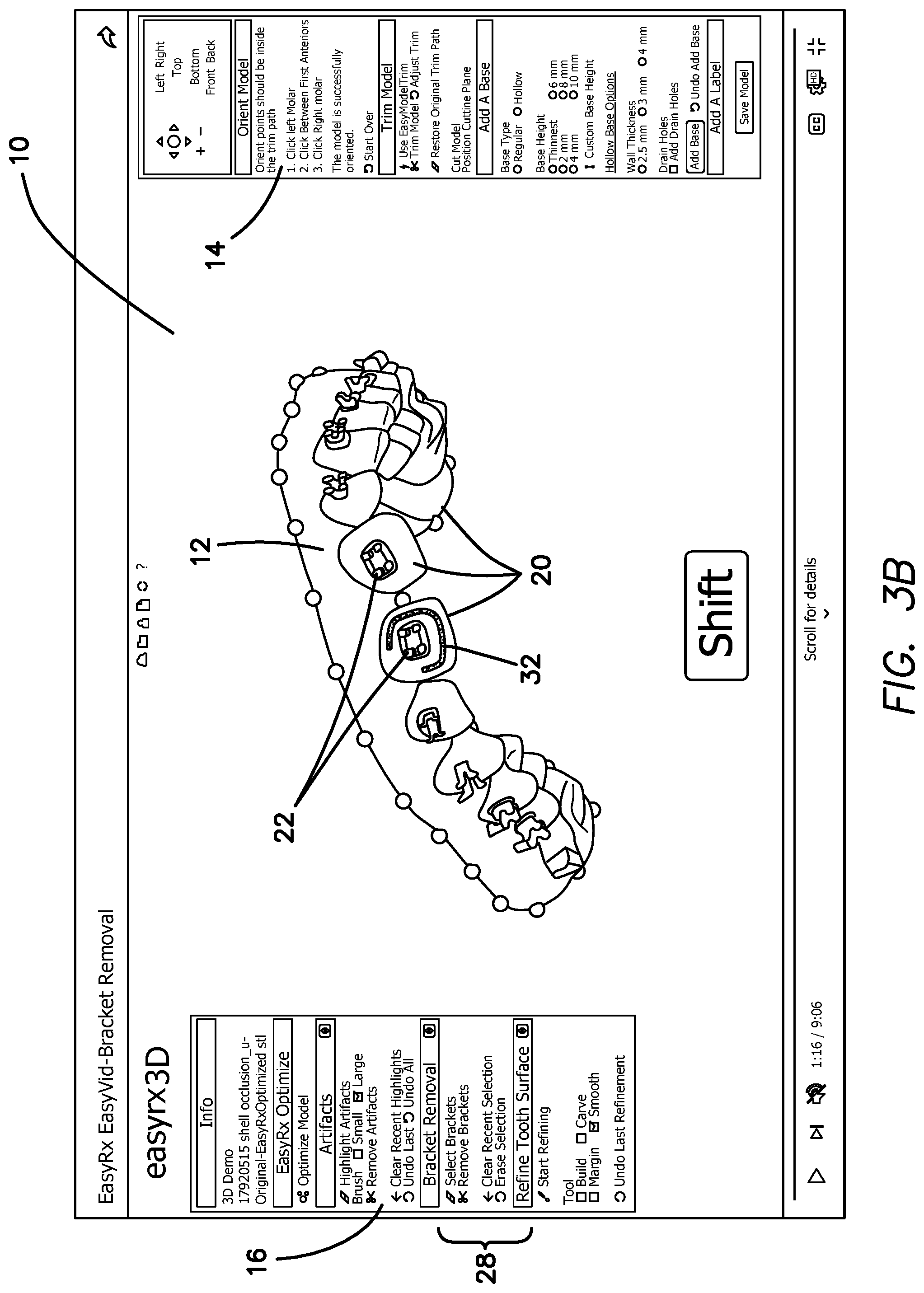 Patent US12322059 Figure 4 – System and method for removing brackets from customized orthodontic appliances and products
