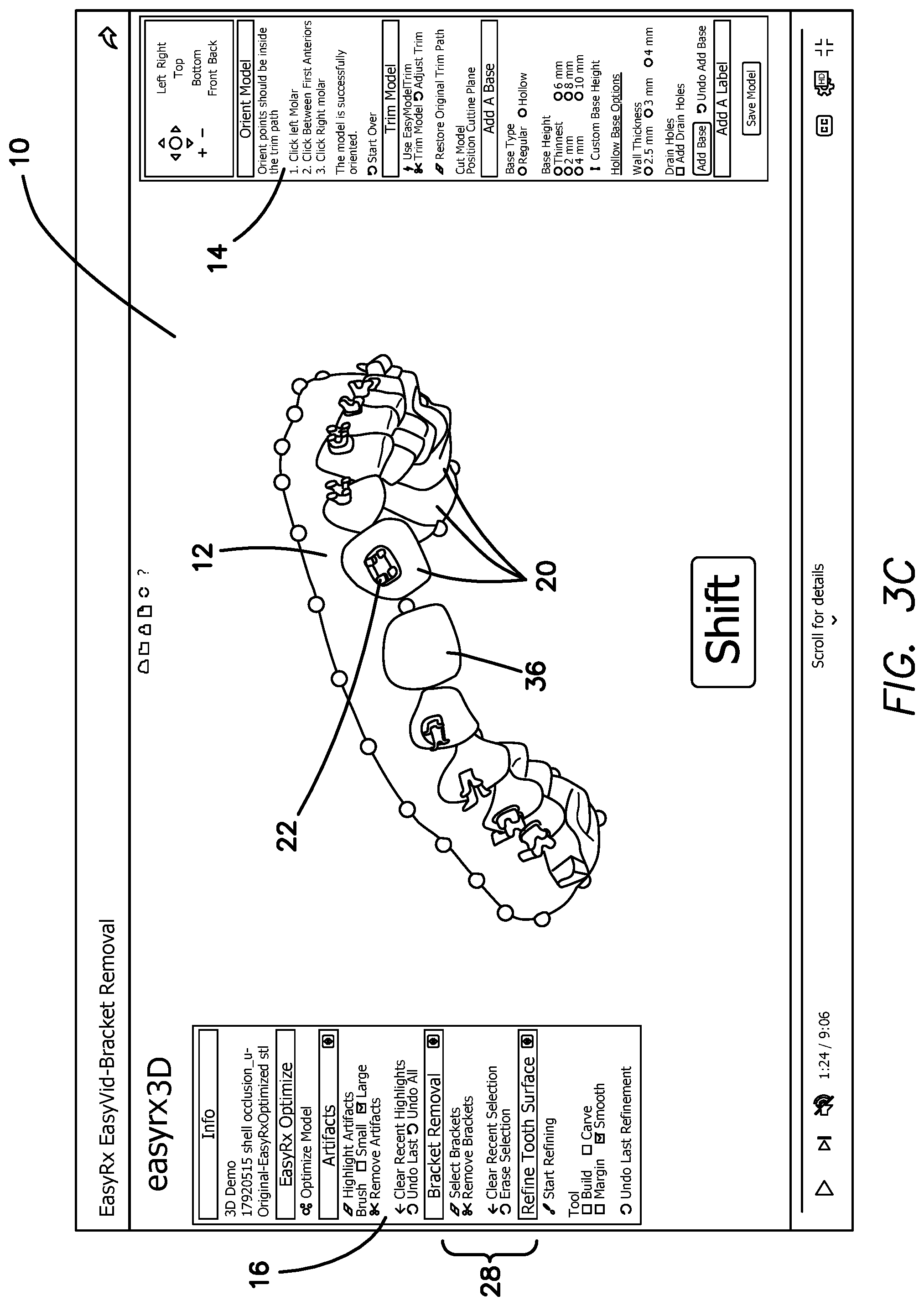 Patent US12322059 Figure 5 – System and method for removing brackets from customized orthodontic appliances and products