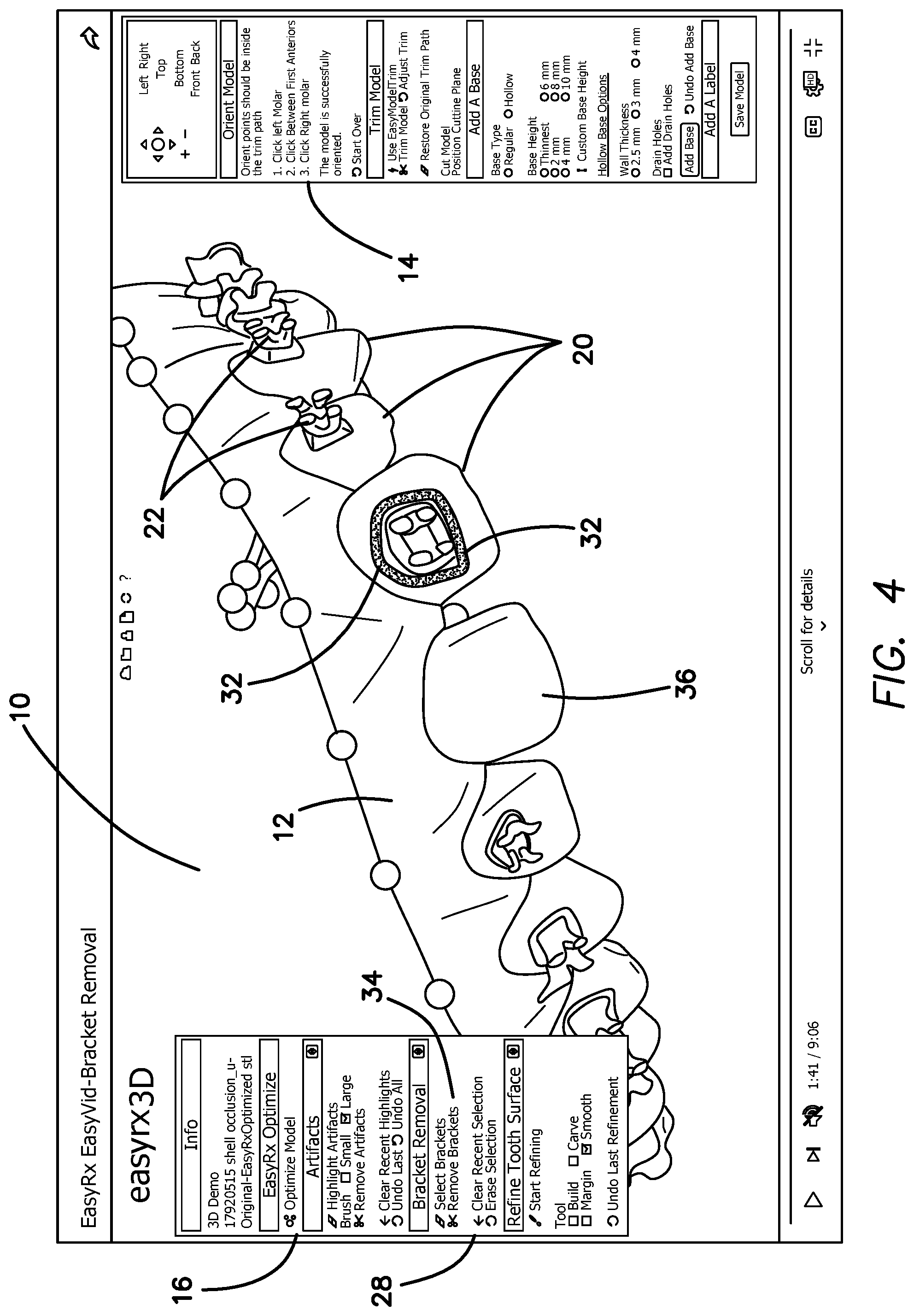 Patent US12322059 Figure 6 – System and method for removing brackets from customized orthodontic appliances and products