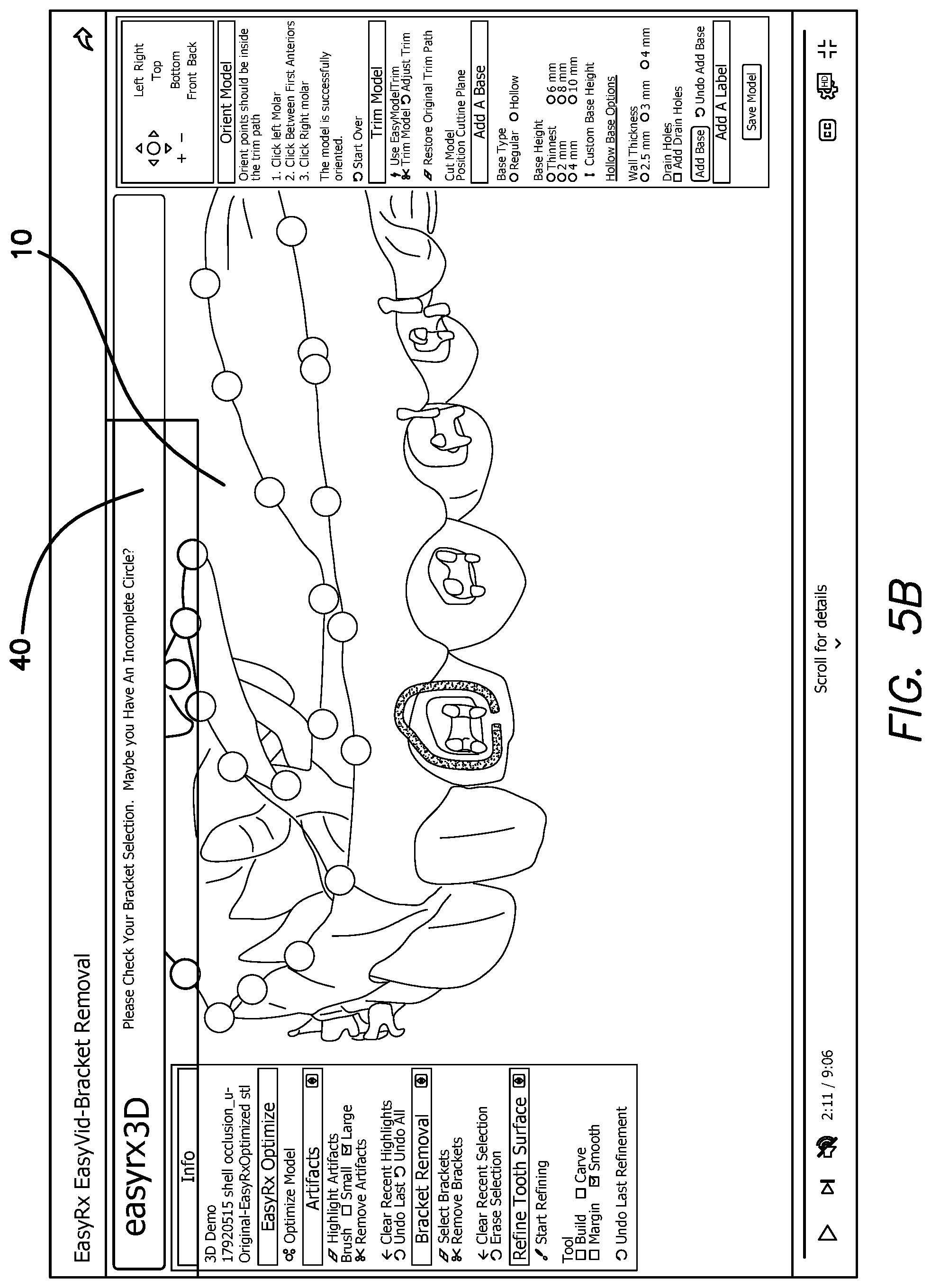 Patent US12322059 Figure 8 – System and method for removing brackets from customized orthodontic appliances and products