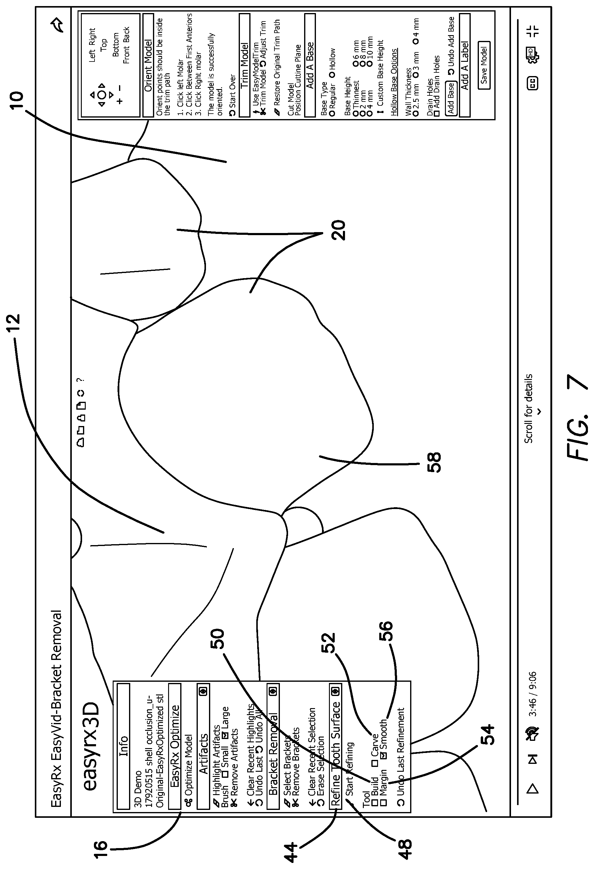 Patent US12322059 Figure 10 – System and method for removing brackets from customized orthodontic appliances and products