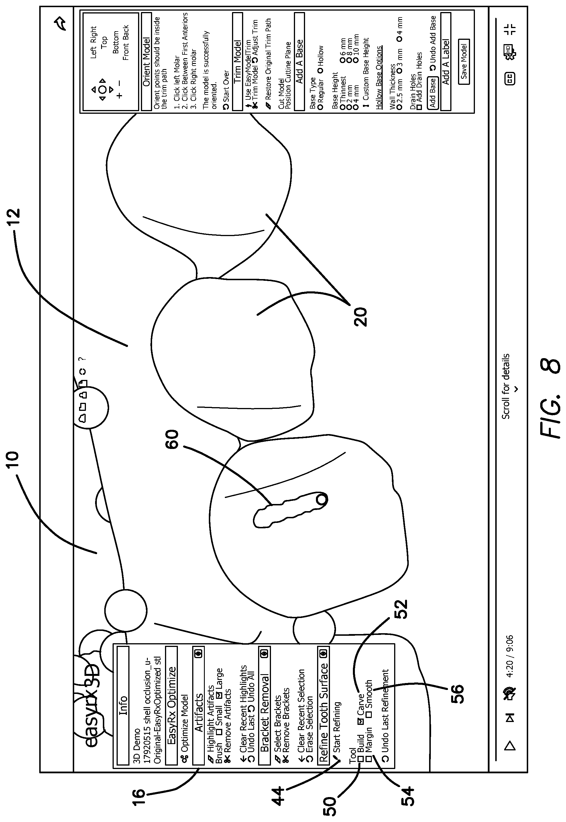Patent US12322059 Figure 11 – System and method for removing brackets from customized orthodontic appliances and products