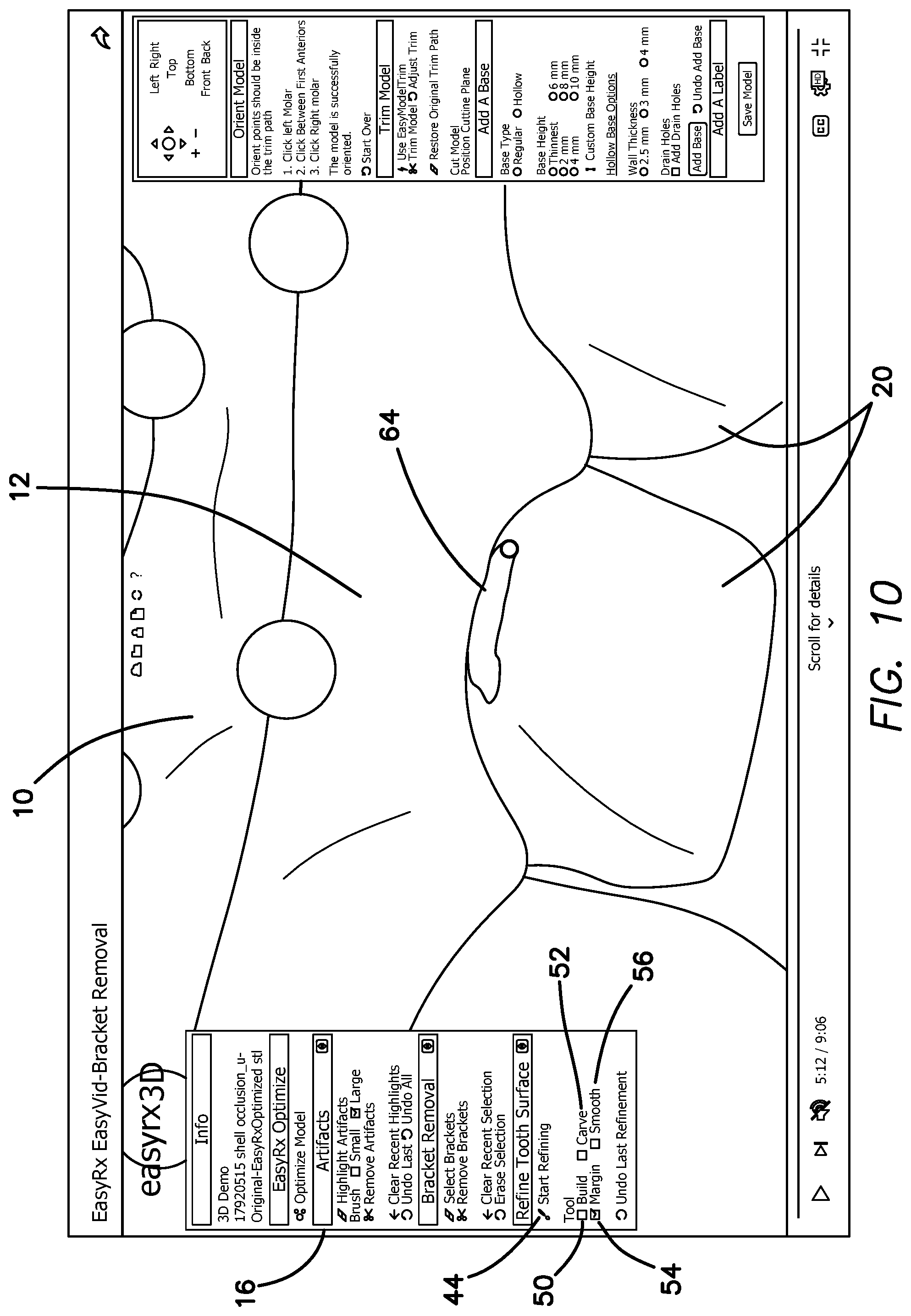 Patent US12322059 Figure 13 – System and method for removing brackets from customized orthodontic appliances and products