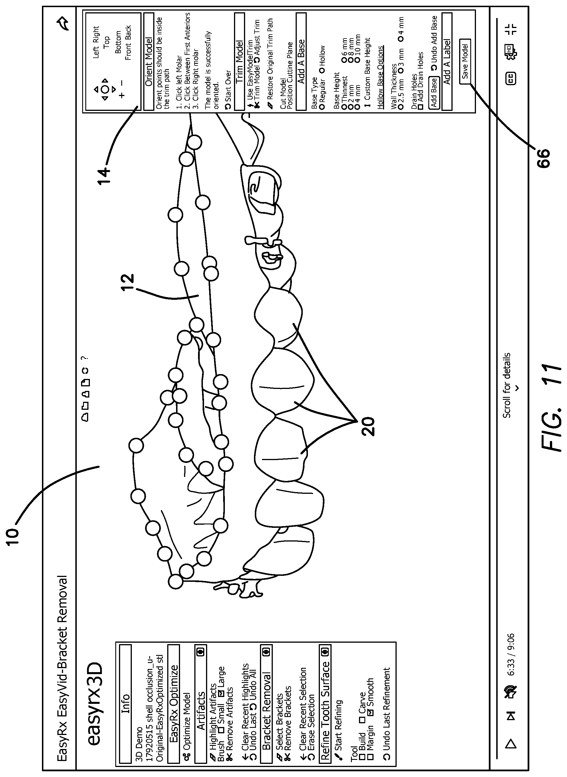 Patent US12322059 Figure 14 – System and method for removing brackets from customized orthodontic appliances and products