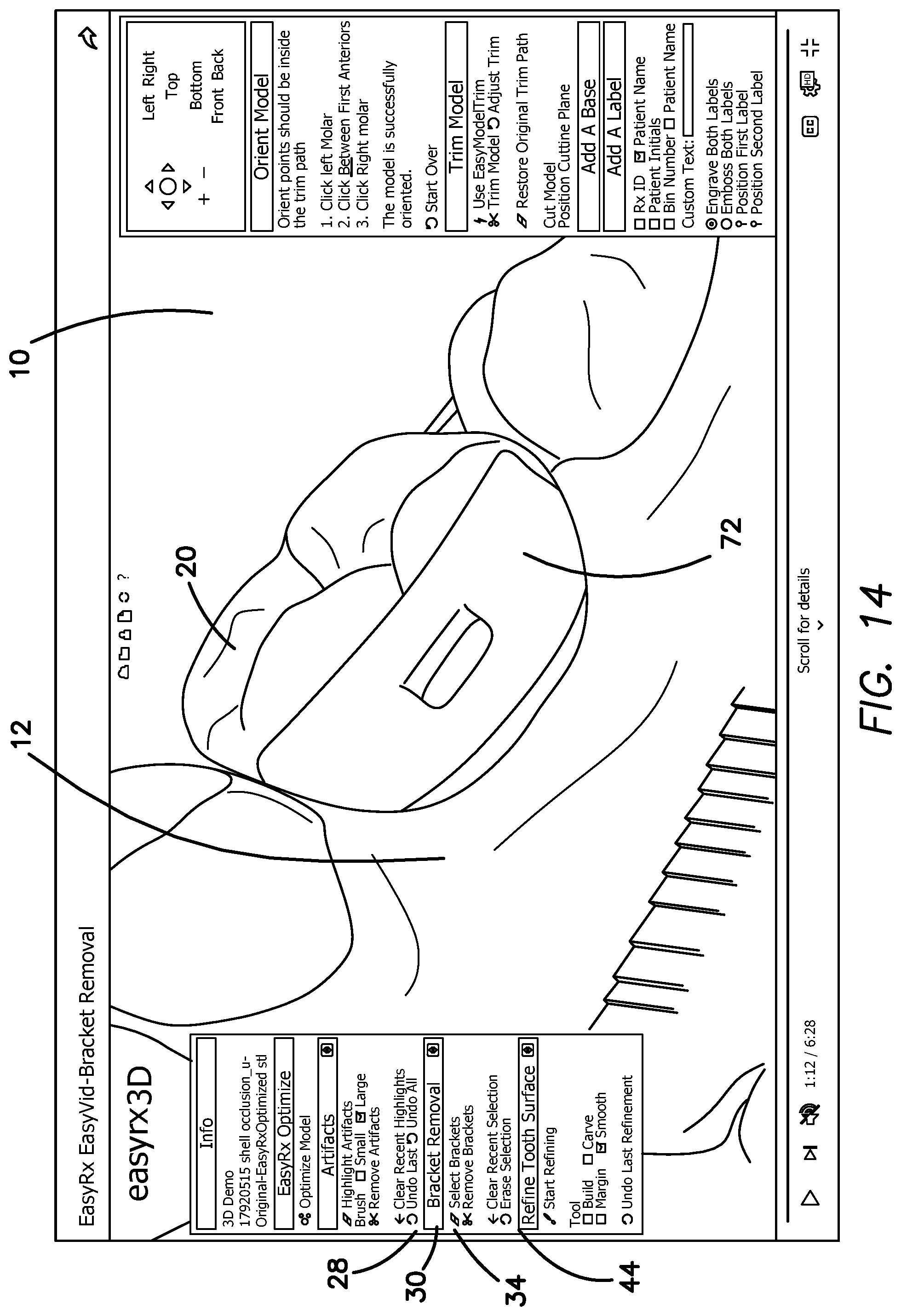 Patent US12322059 Figure 17 – System and method for removing brackets from customized orthodontic appliances and products