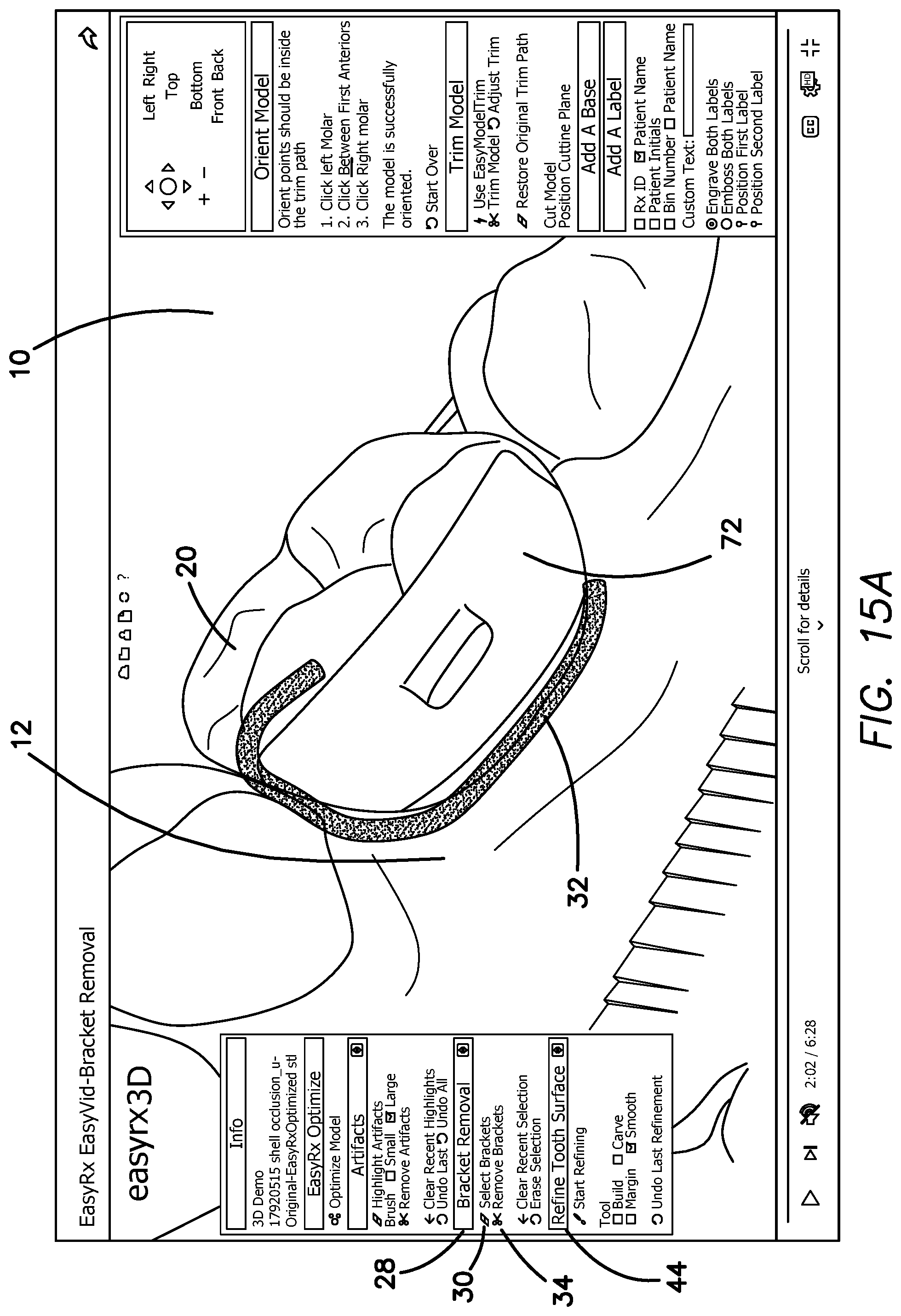 Patent US12322059 Figure 18 – System and method for removing brackets from customized orthodontic appliances and products