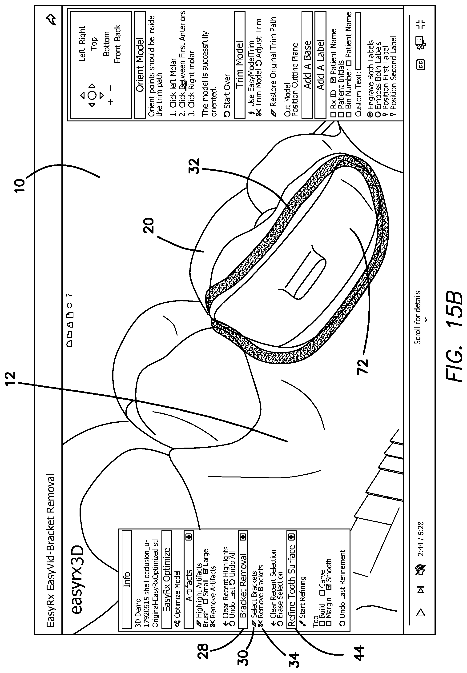 Patent US12322059 Figure 19 – System and method for removing brackets from customized orthodontic appliances and products
