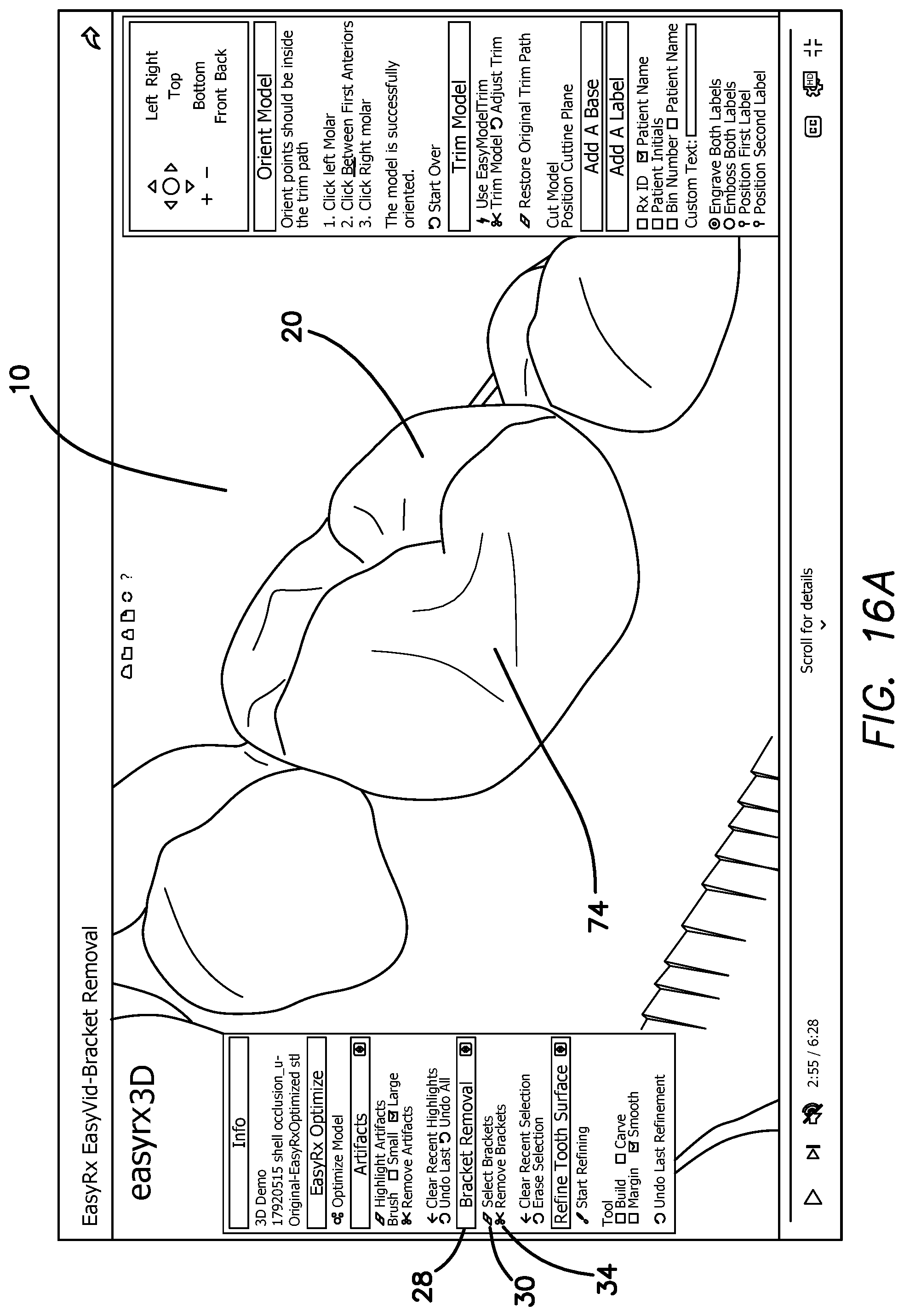 Patent US12322059 Figure 20 – System and method for removing brackets from customized orthodontic appliances and products