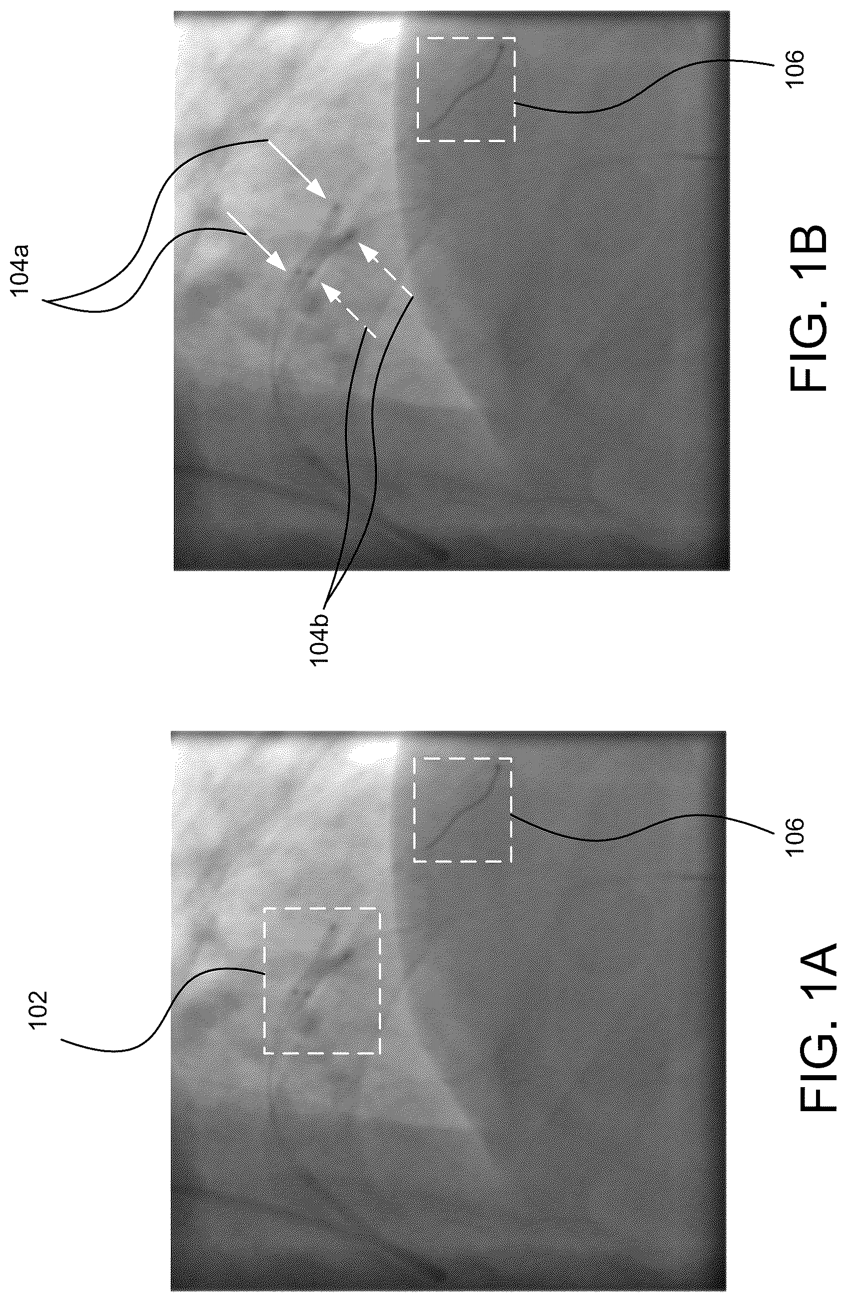 Patent US12322088 Figure 1 – Detecting and enhancing objects in medical images