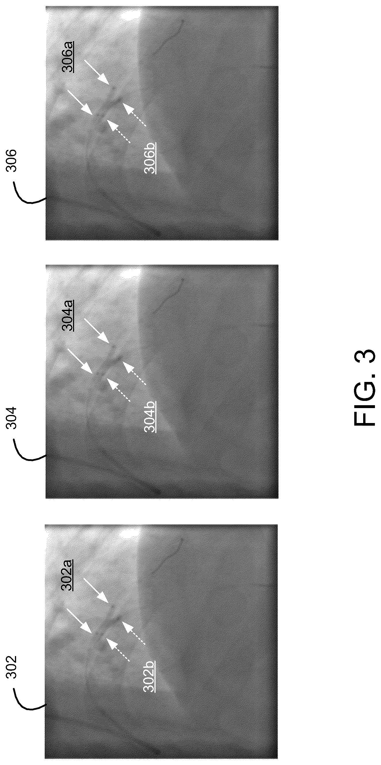Patent US12322088 Figure 3 – Detecting and enhancing objects in medical images