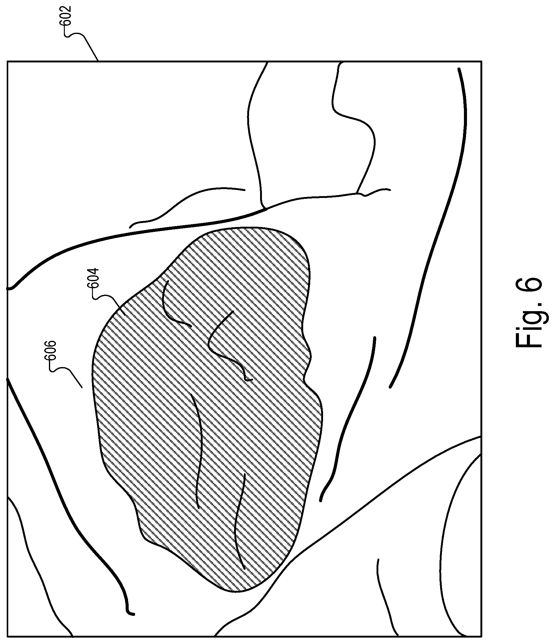 Patent US12322089 Figure 6 – Physical medical element sizing systems and methods