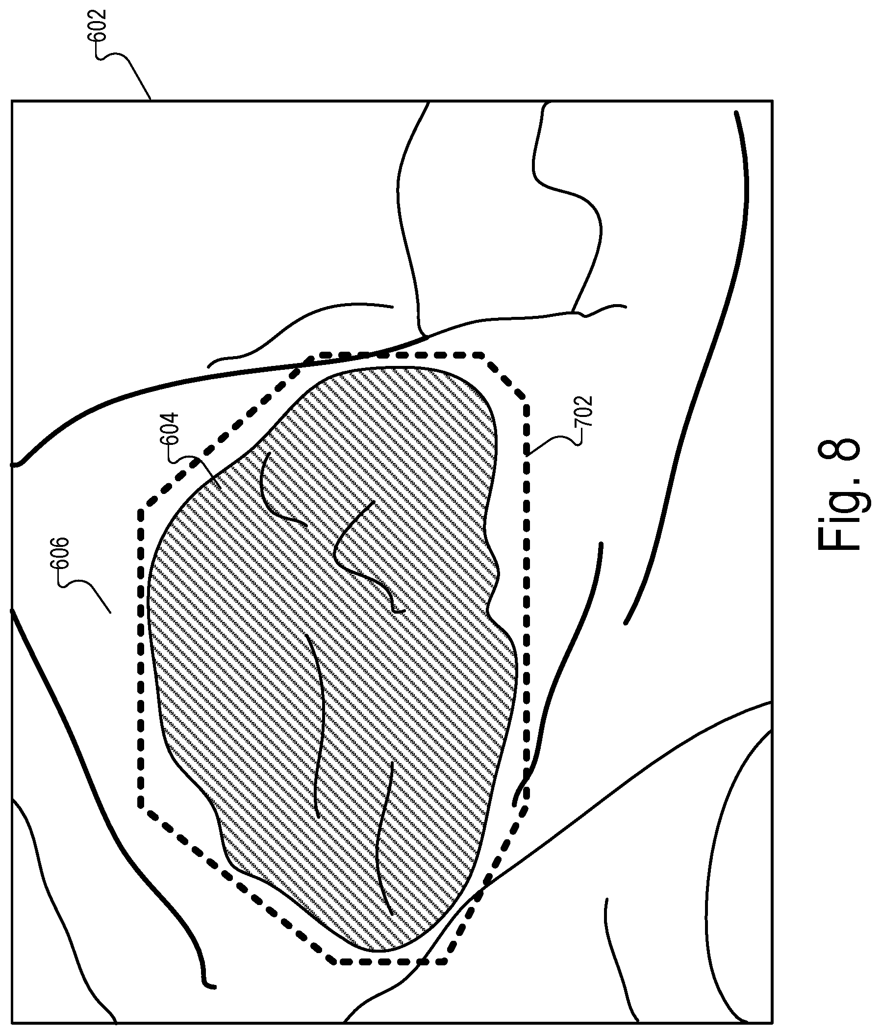 Patent US12322089 Figure 8 – Physical medical element sizing systems and methods