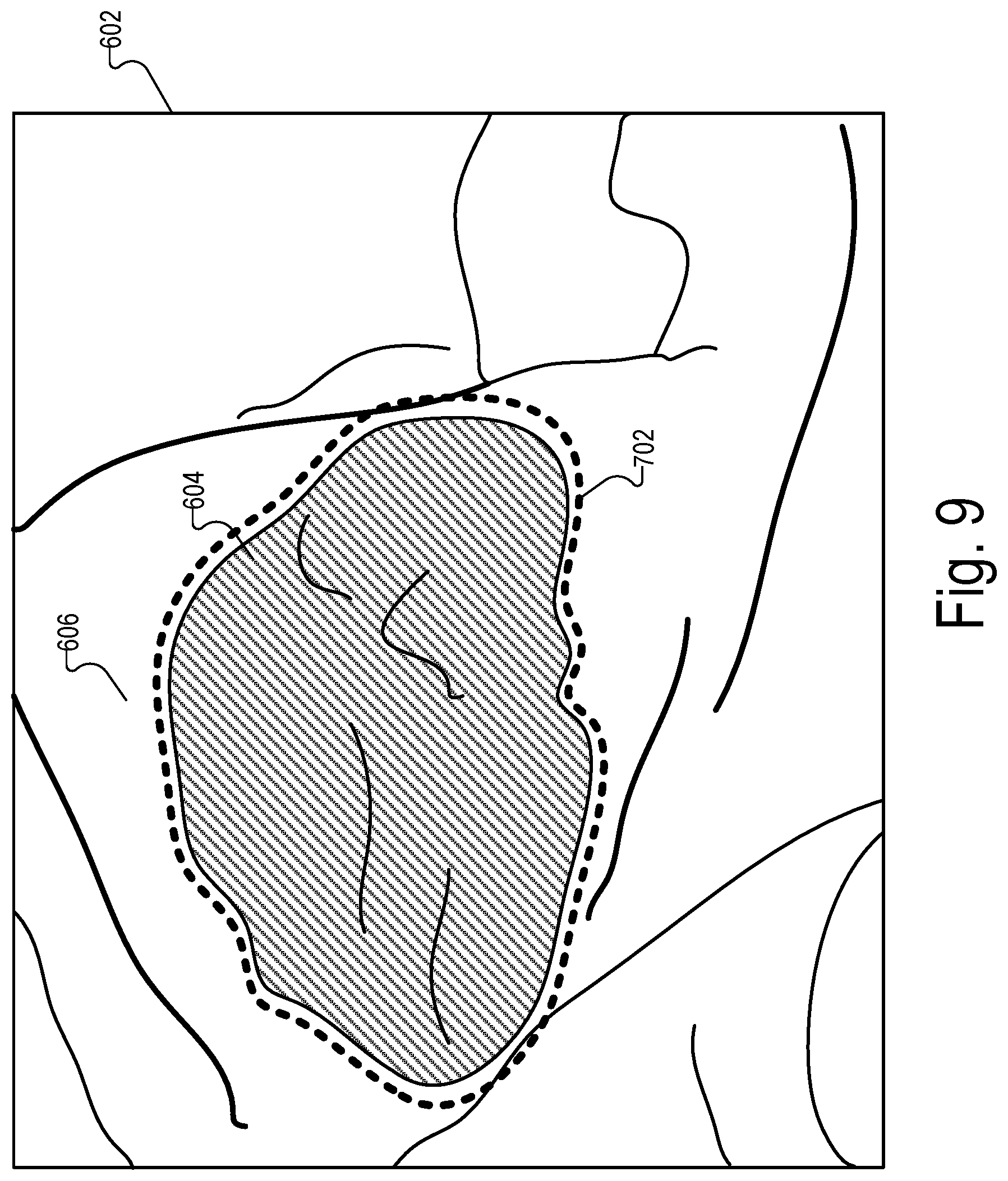 Patent US12322089 Figure 9 – Physical medical element sizing systems and methods