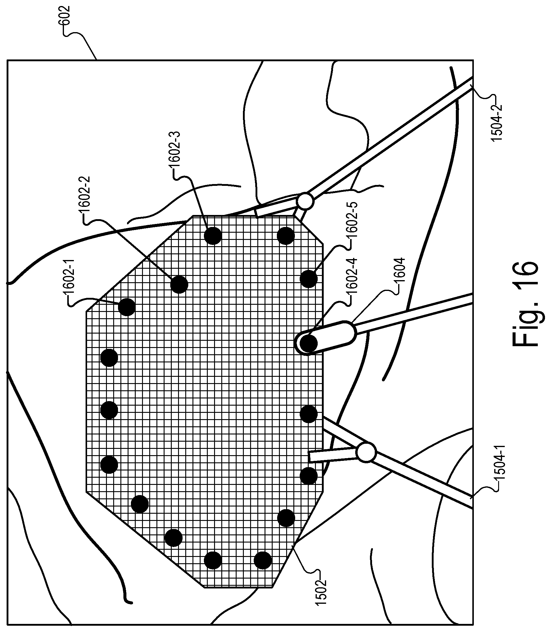 Patent US12322089 Figure 16 – Physical medical element sizing systems and methods