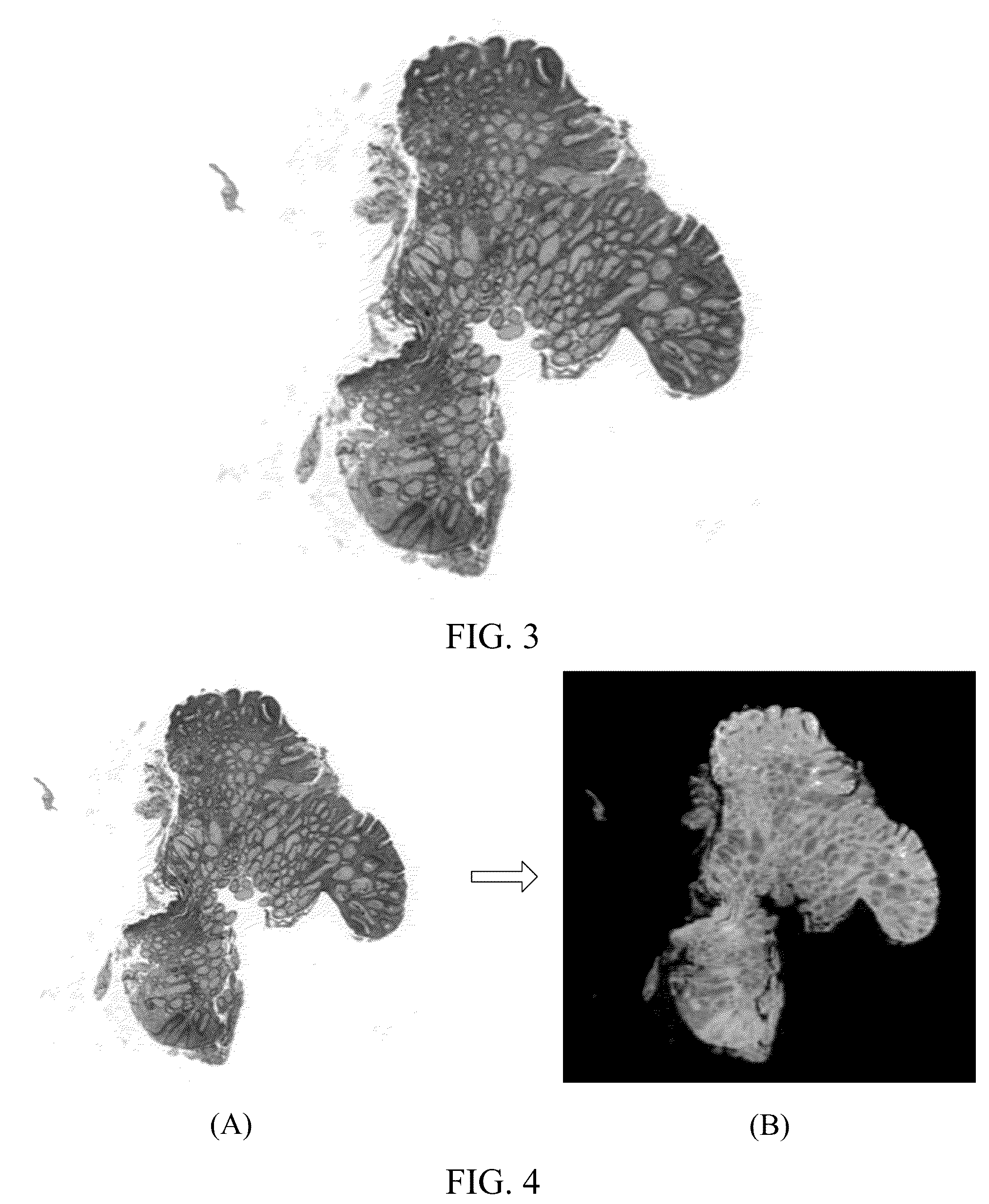 Patent US12322092 Figure 2 – Medical image processing method and apparatus, image processing method and apparatus, terminal and storage medium