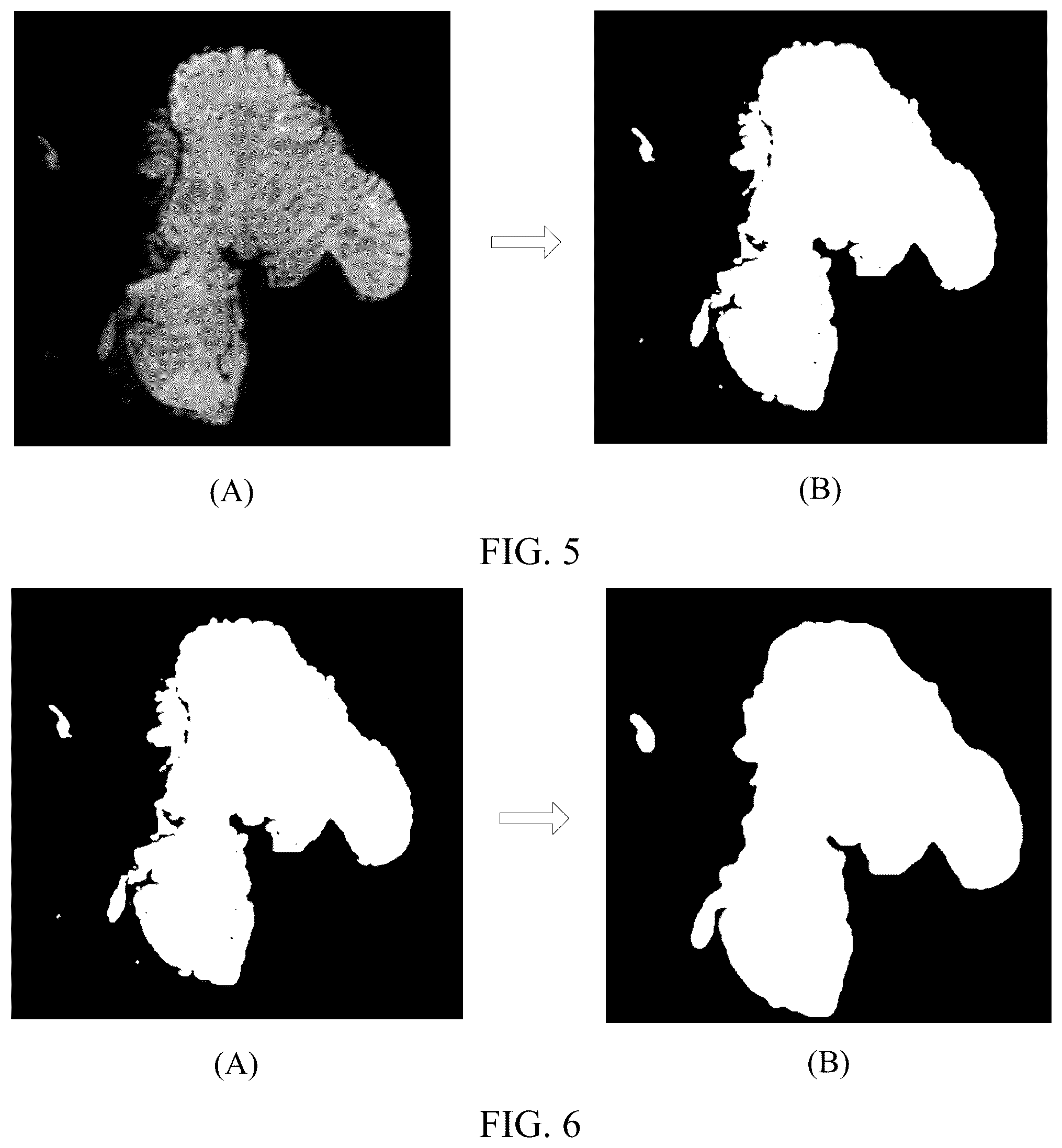 Patent US12322092 Figure 3 – Medical image processing method and apparatus, image processing method and apparatus, terminal and storage medium