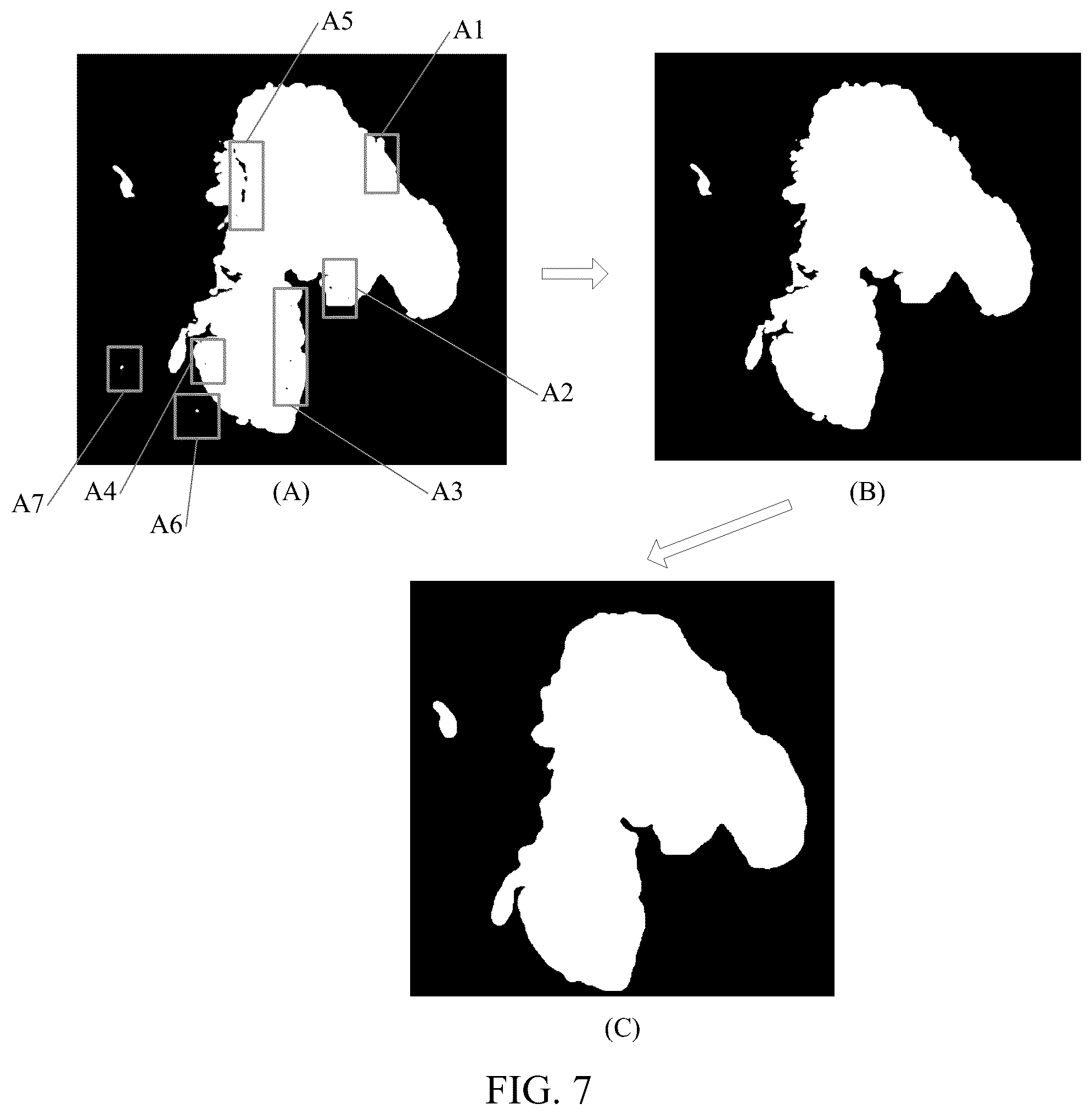 Patent US12322092 Figure 4 – Medical image processing method and apparatus, image processing method and apparatus, terminal and storage medium