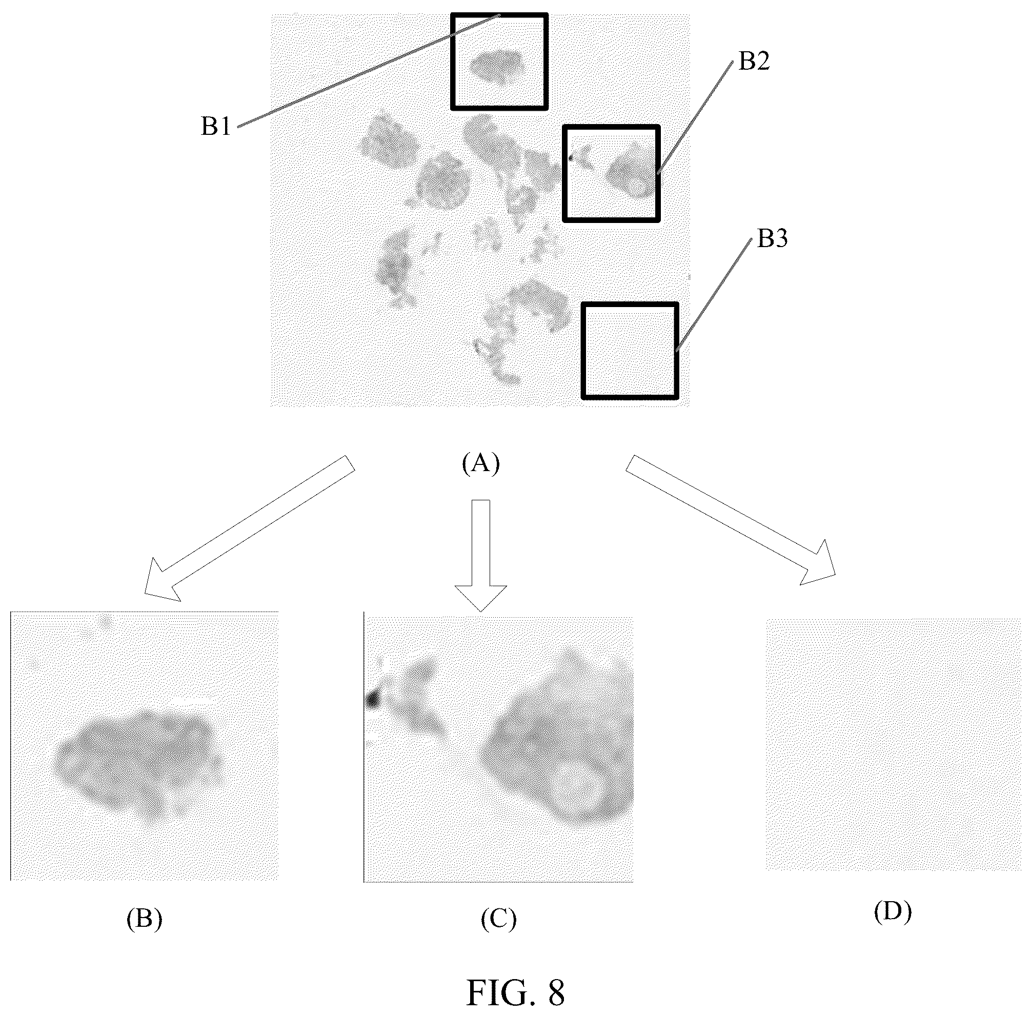 Patent US12322092 Figure 5 – Medical image processing method and apparatus, image processing method and apparatus, terminal and storage medium