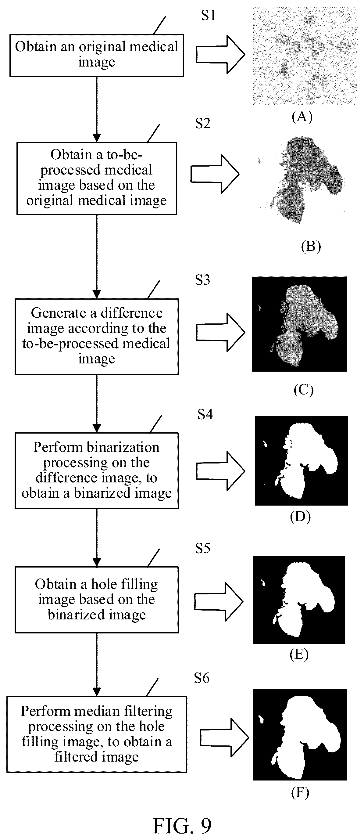Patent US12322092 Figure 6 – Medical image processing method and apparatus, image processing method and apparatus, terminal and storage medium