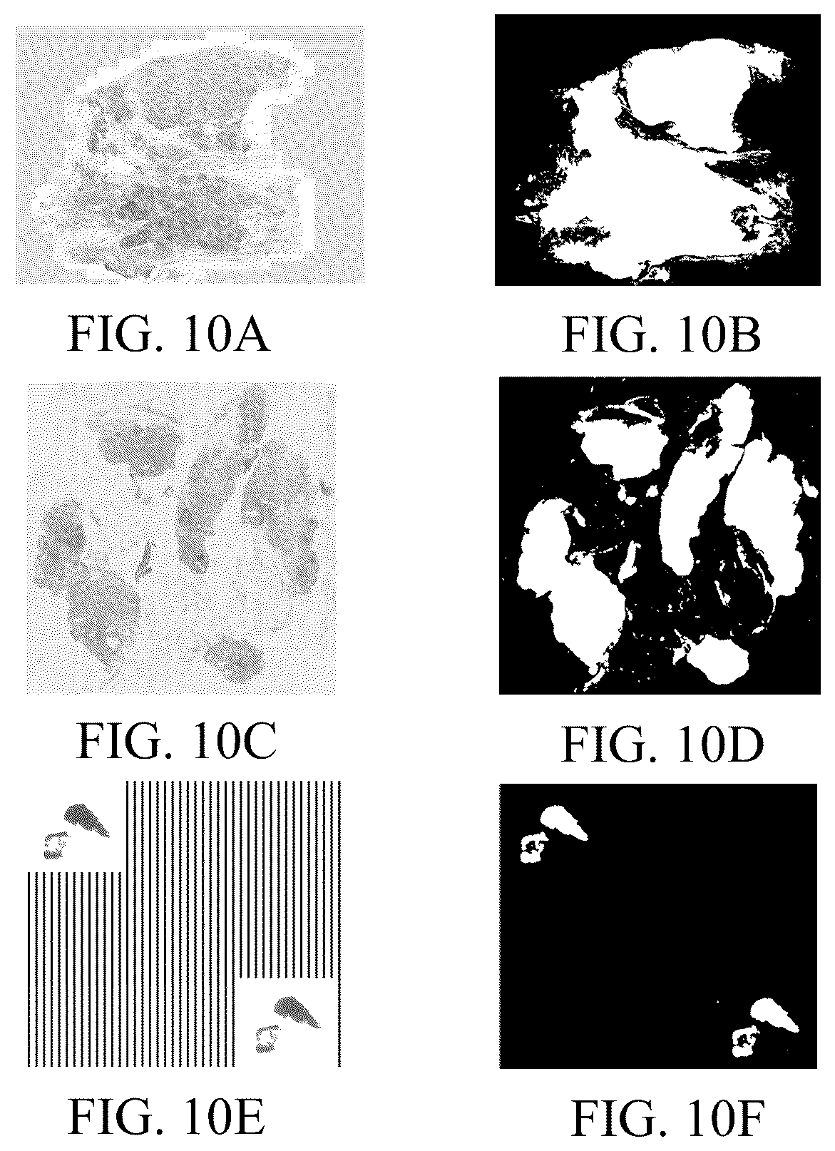 Patent US12322092 Figure 7 – Medical image processing method and apparatus, image processing method and apparatus, terminal and storage medium