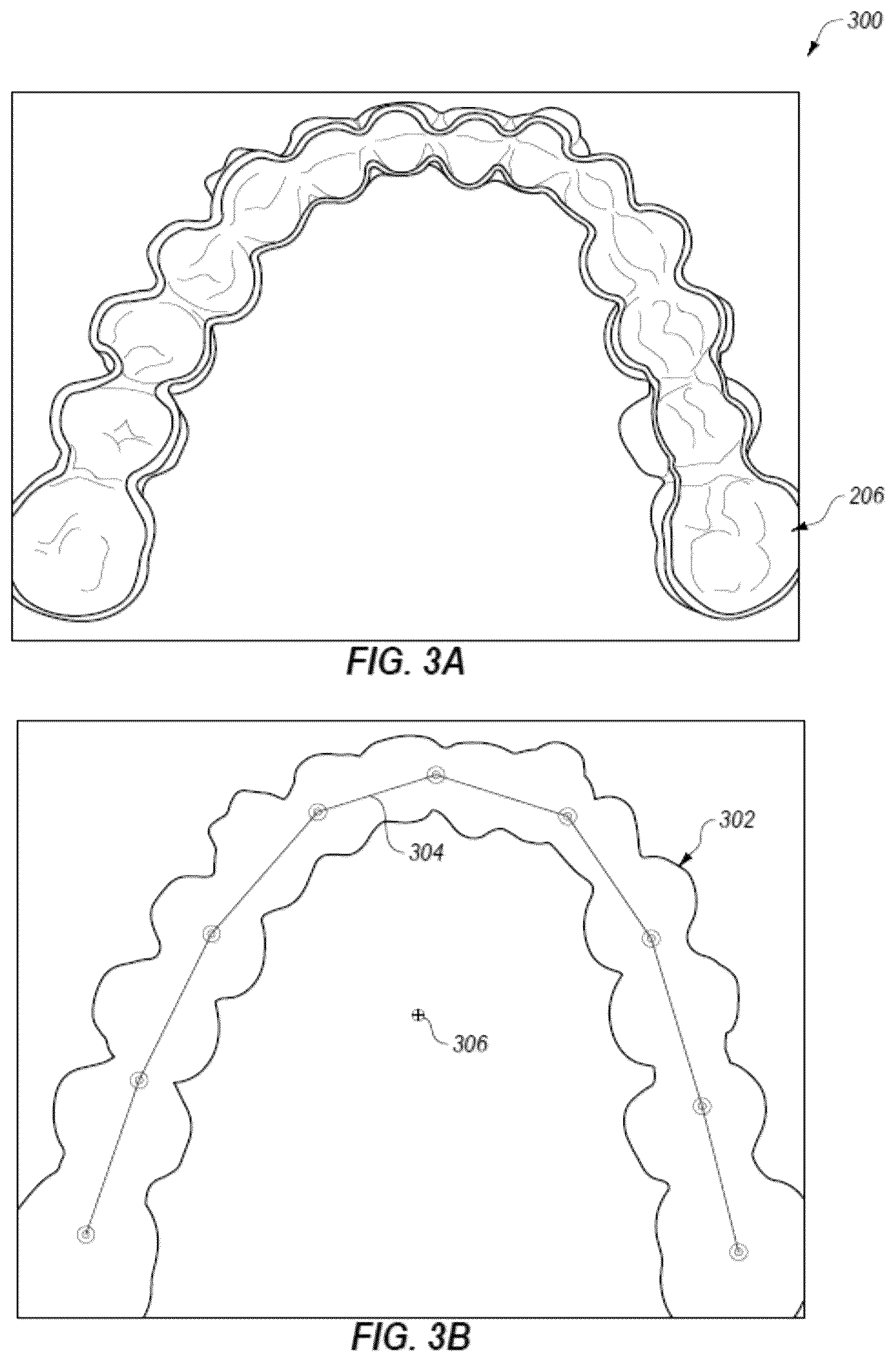 Patent US12322093 Figure 4 – Methods for manufacturing and inspecting orthodontic aligners