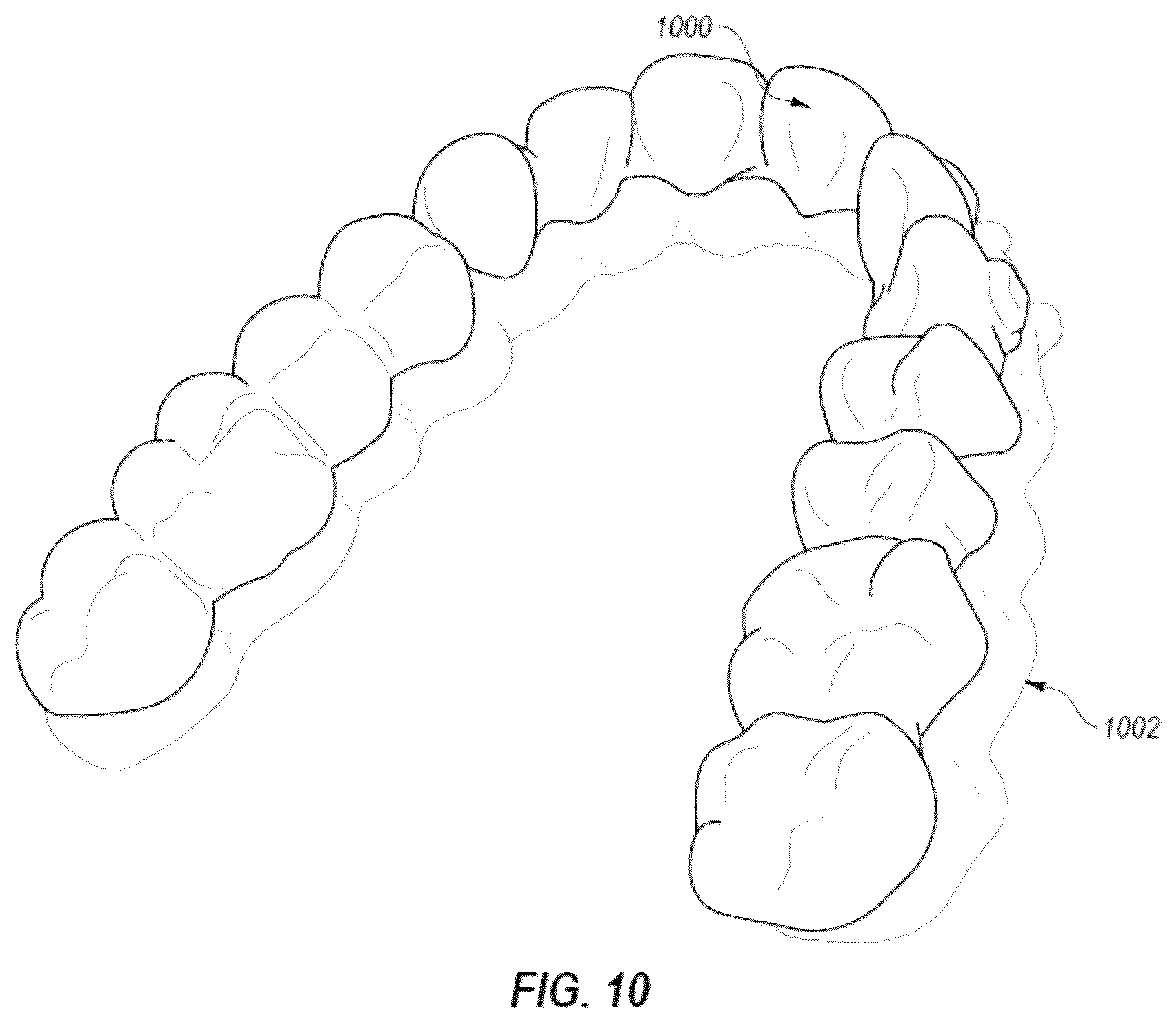 Patent US12322093 Figure 13 – Methods for manufacturing and inspecting orthodontic aligners