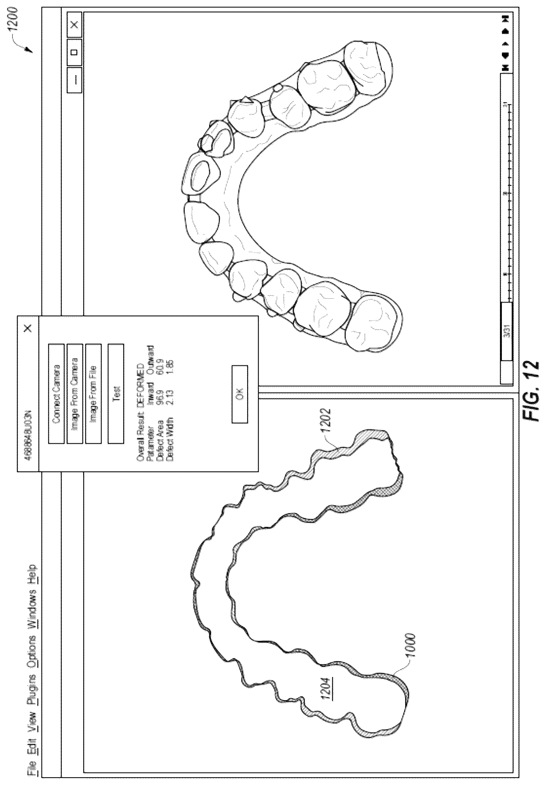 Patent US12322093 Figure 15 – Methods for manufacturing and inspecting orthodontic aligners