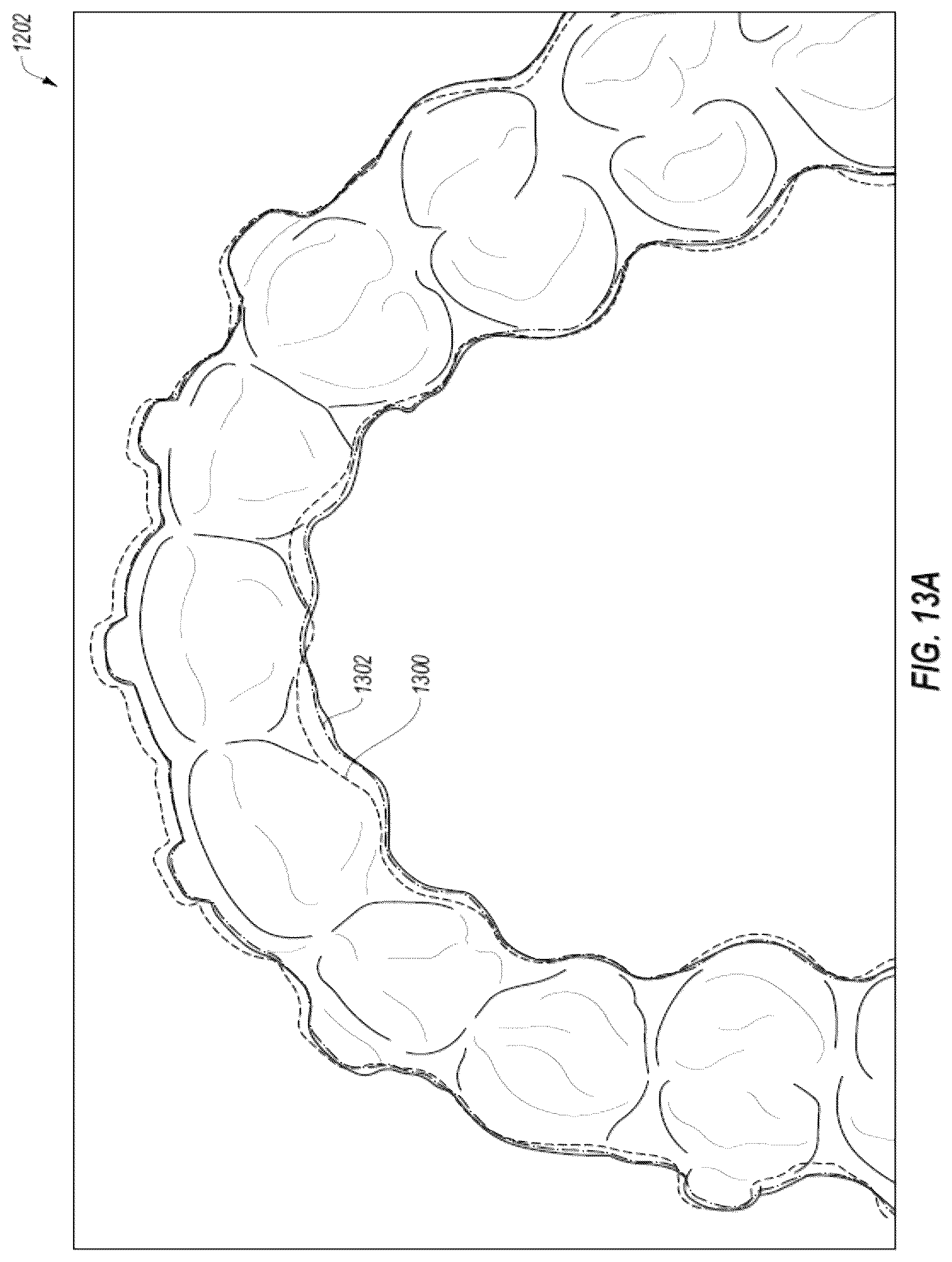 Patent US12322093 Figure 16 – Methods for manufacturing and inspecting orthodontic aligners