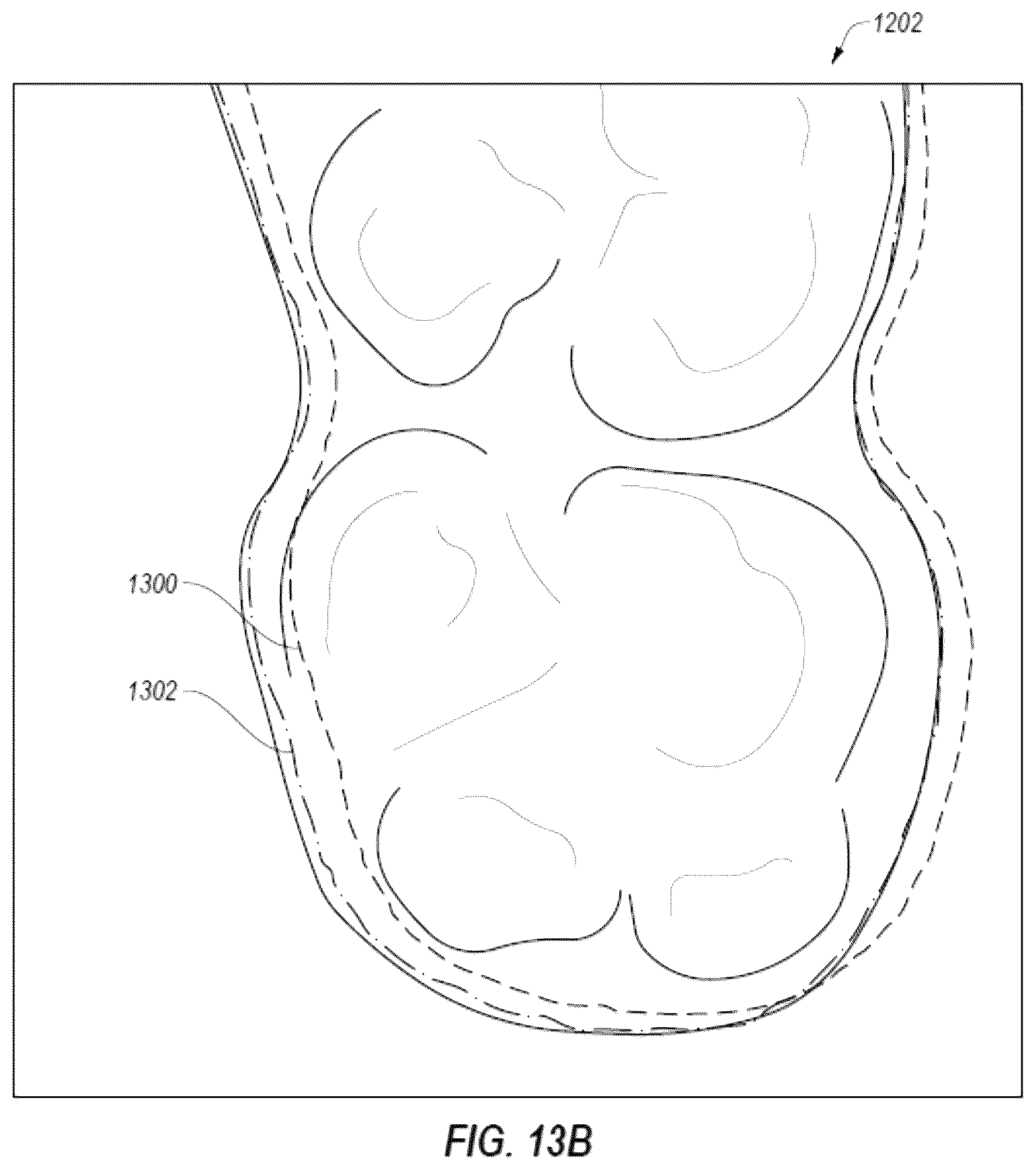 Patent US12322093 Figure 17 – Methods for manufacturing and inspecting orthodontic aligners
