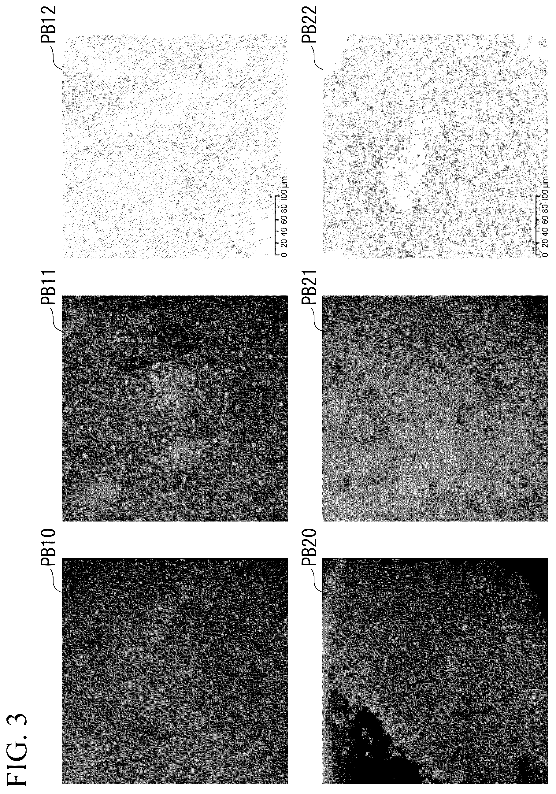 Patent US12322094 Figure 3 – Image acquiring device, cancer determination device, cancer determination method, and computer-readable medium