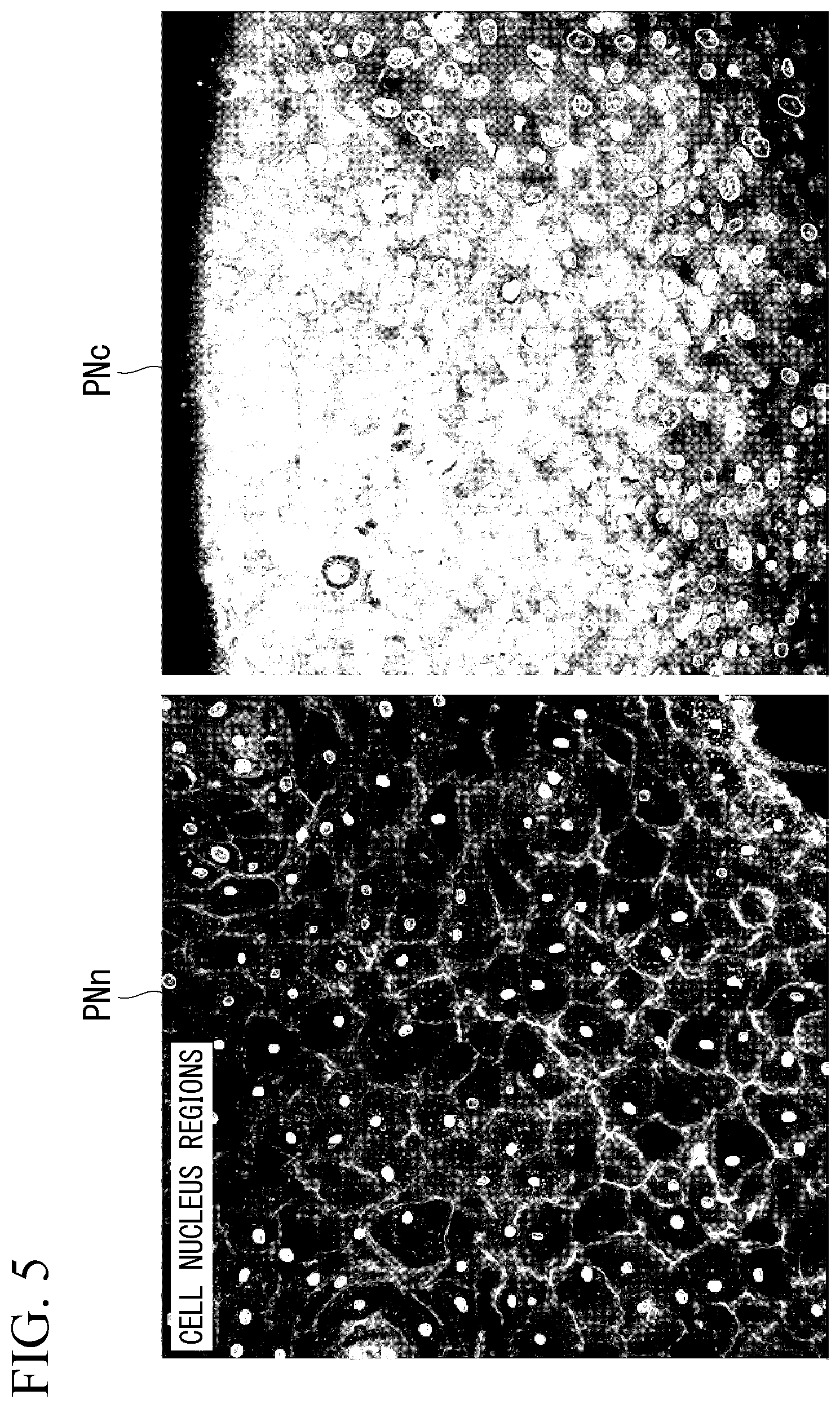 Patent US12322094 Figure 5 – Image acquiring device, cancer determination device, cancer determination method, and computer-readable medium