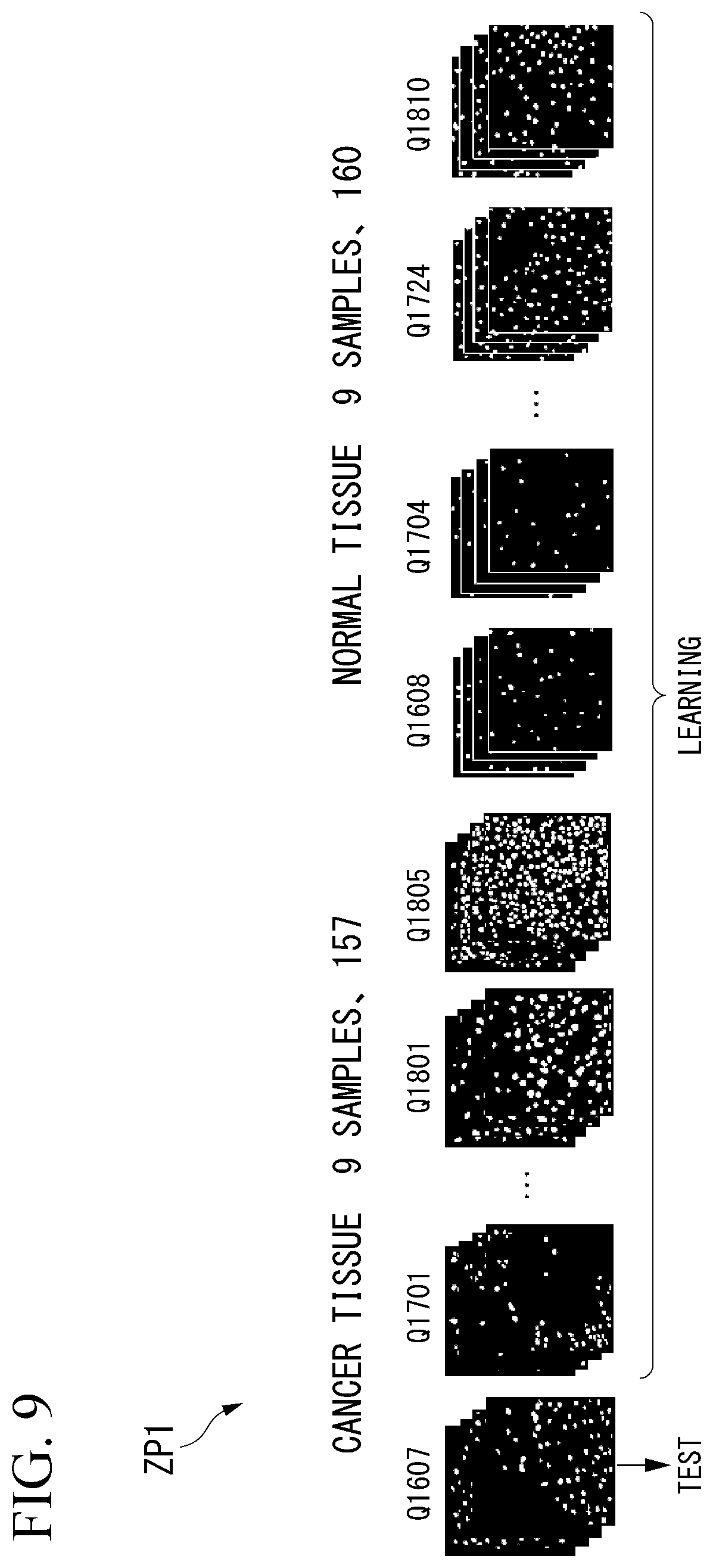 Patent US12322094 Figure 9 – Image acquiring device, cancer determination device, cancer determination method, and computer-readable medium