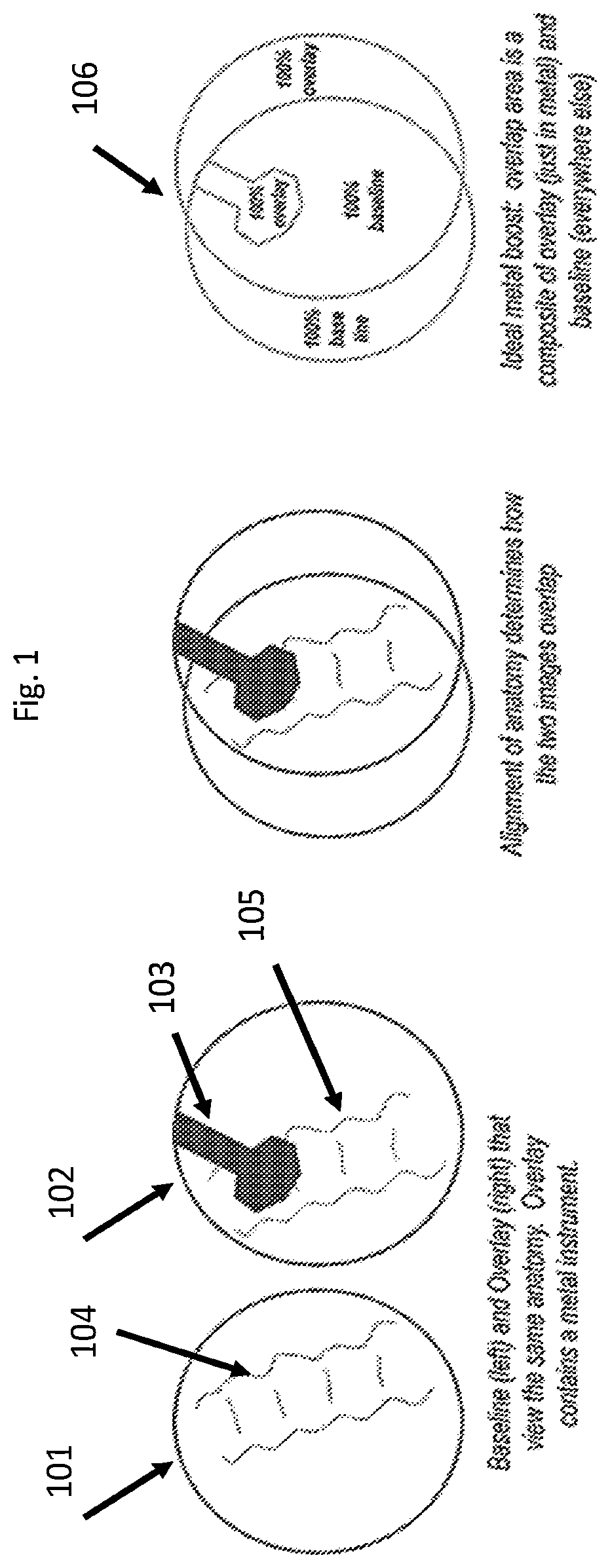 Patent US12322095 — Adjusting appearance of objects in medical images — Figure 1