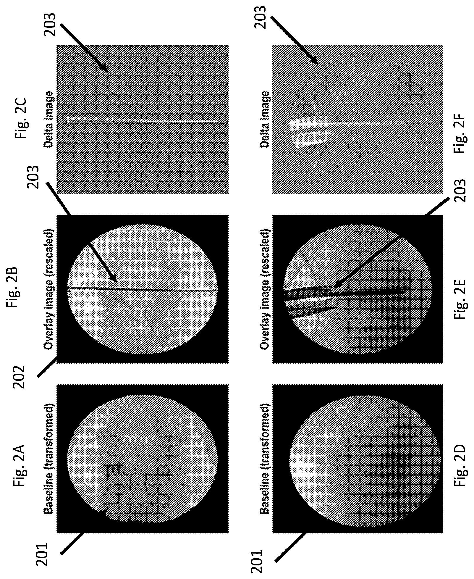 Patent US12322095 Figure 2 – Adjusting appearance of objects in medical images