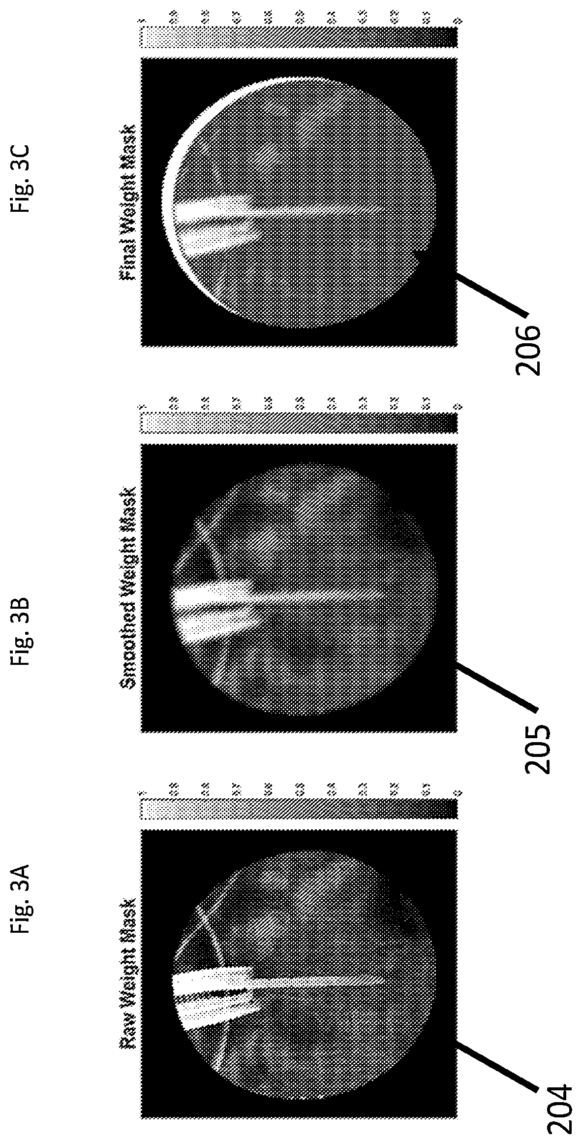 Patent US12322095 Figure 3 – Adjusting appearance of objects in medical images