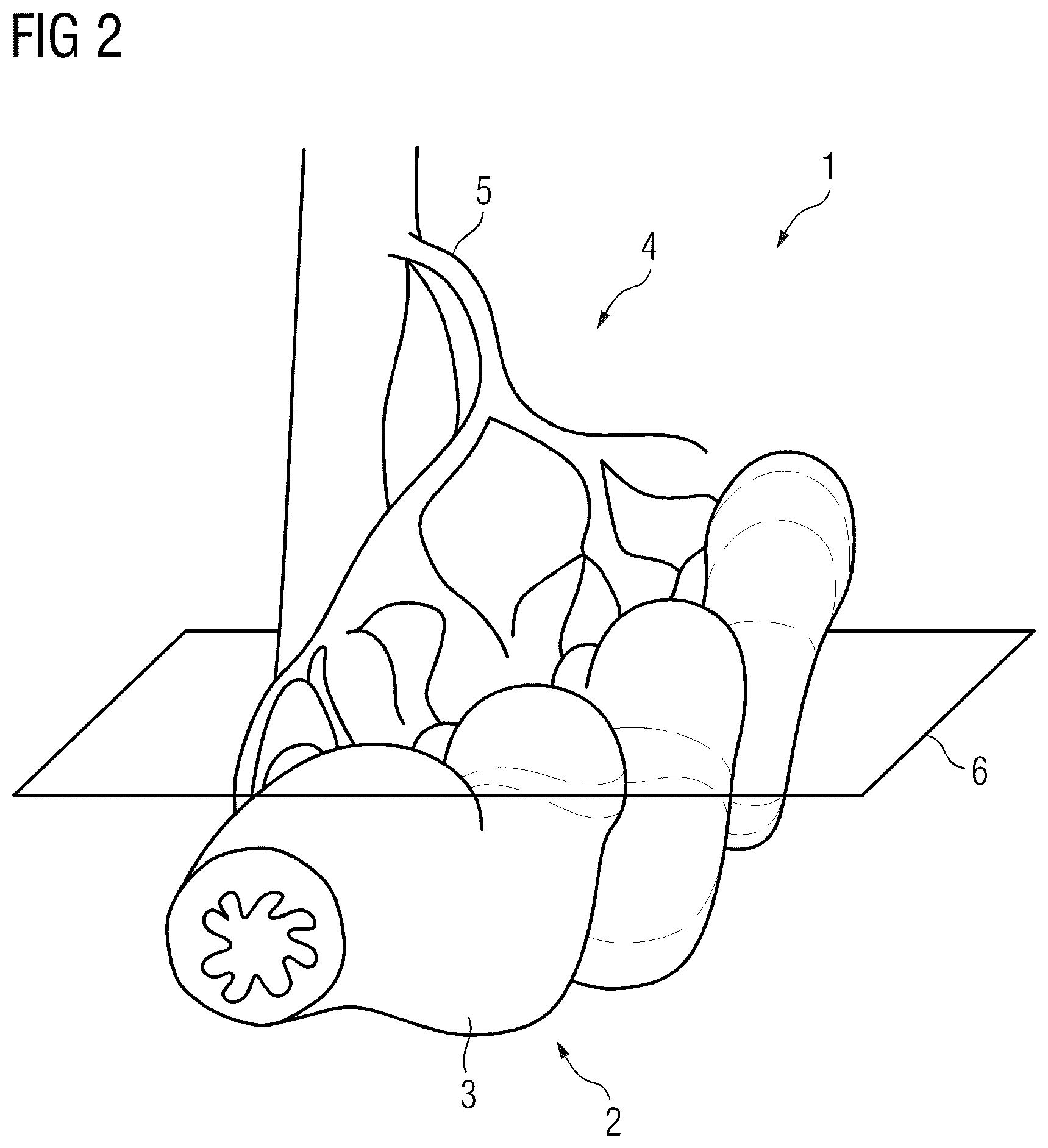 Patent US12322097 Figure 2 – Computer-implemented method for evaluating an angiographic computed tomography dataset, evaluation device, computer program and electronically readable data medium