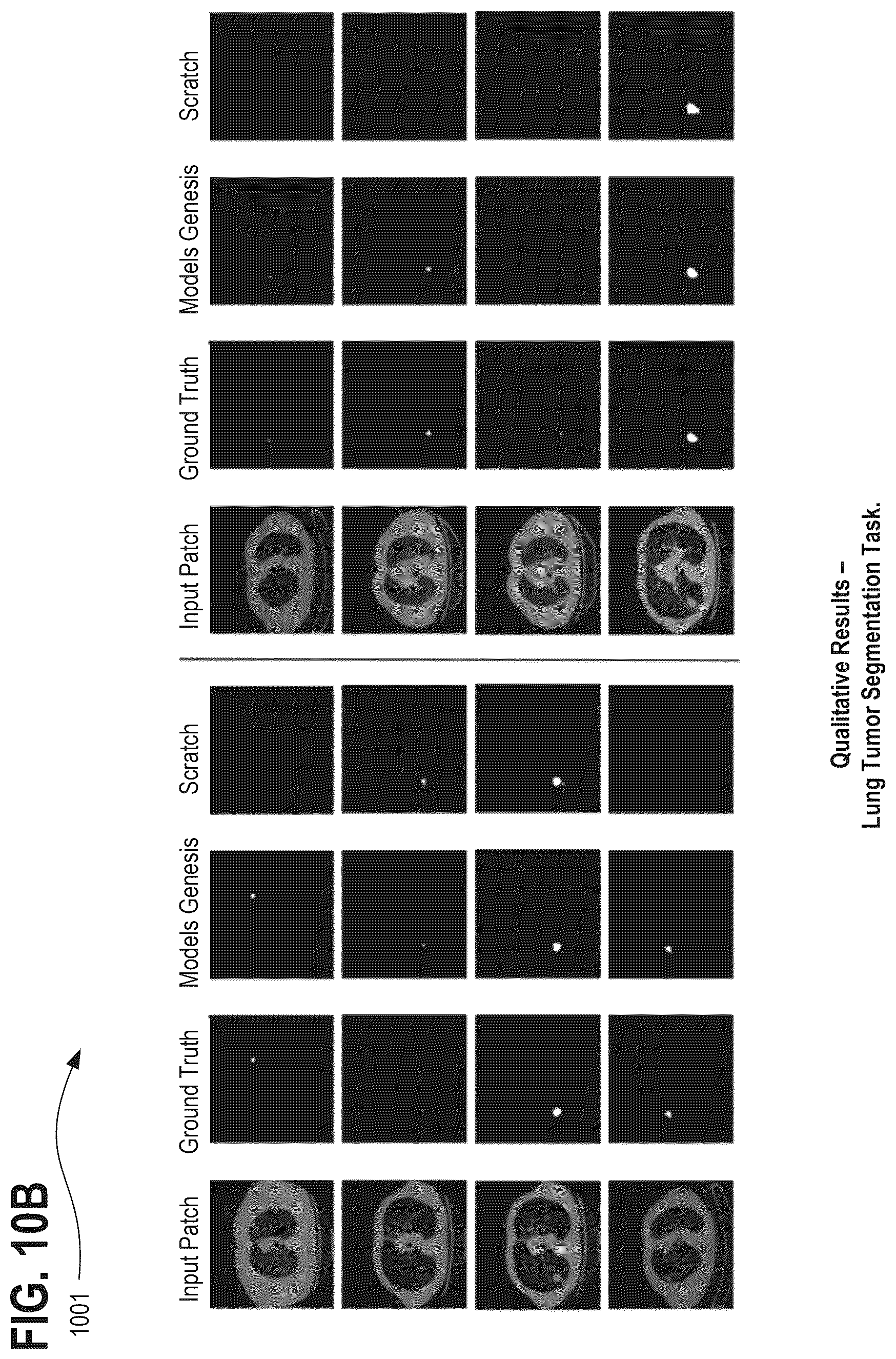 Patent US12322098 Figure 11 – Systems, methods, and apparatuses for generating pre-trained models for nnU-net through the use of improved transfer learning techniques