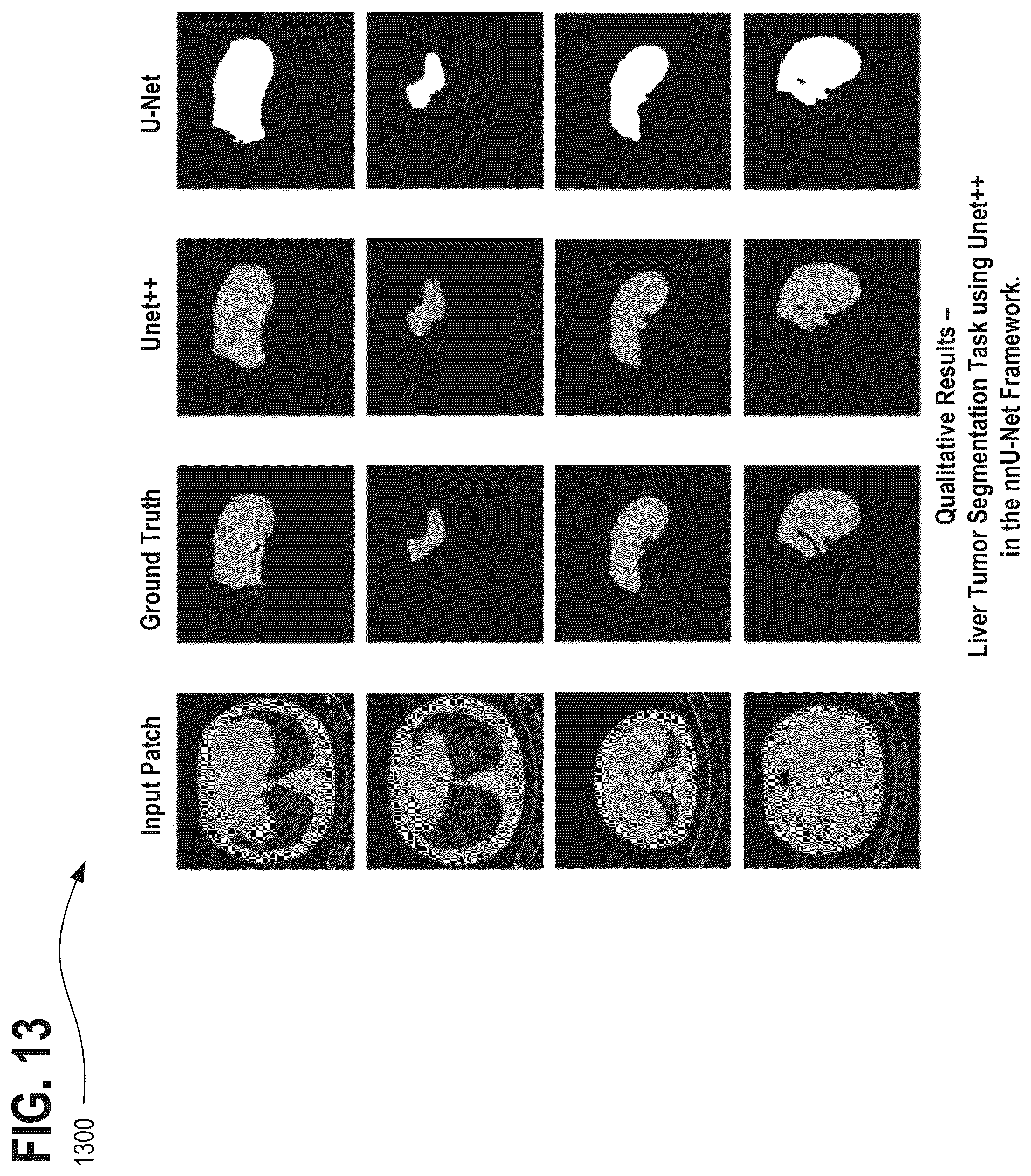 Patent US12322098 Figure 16 – Systems, methods, and apparatuses for generating pre-trained models for nnU-net through the use of improved transfer learning techniques
