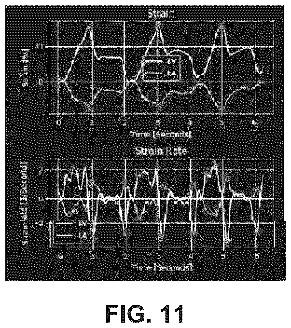 Patent US12322100 Figure 16 – Automatic clinical workflow that recognizes and analyzes 2D and doppler modality echocardiogram images for automated cardiac measurements and grading of aortic stenosis severity