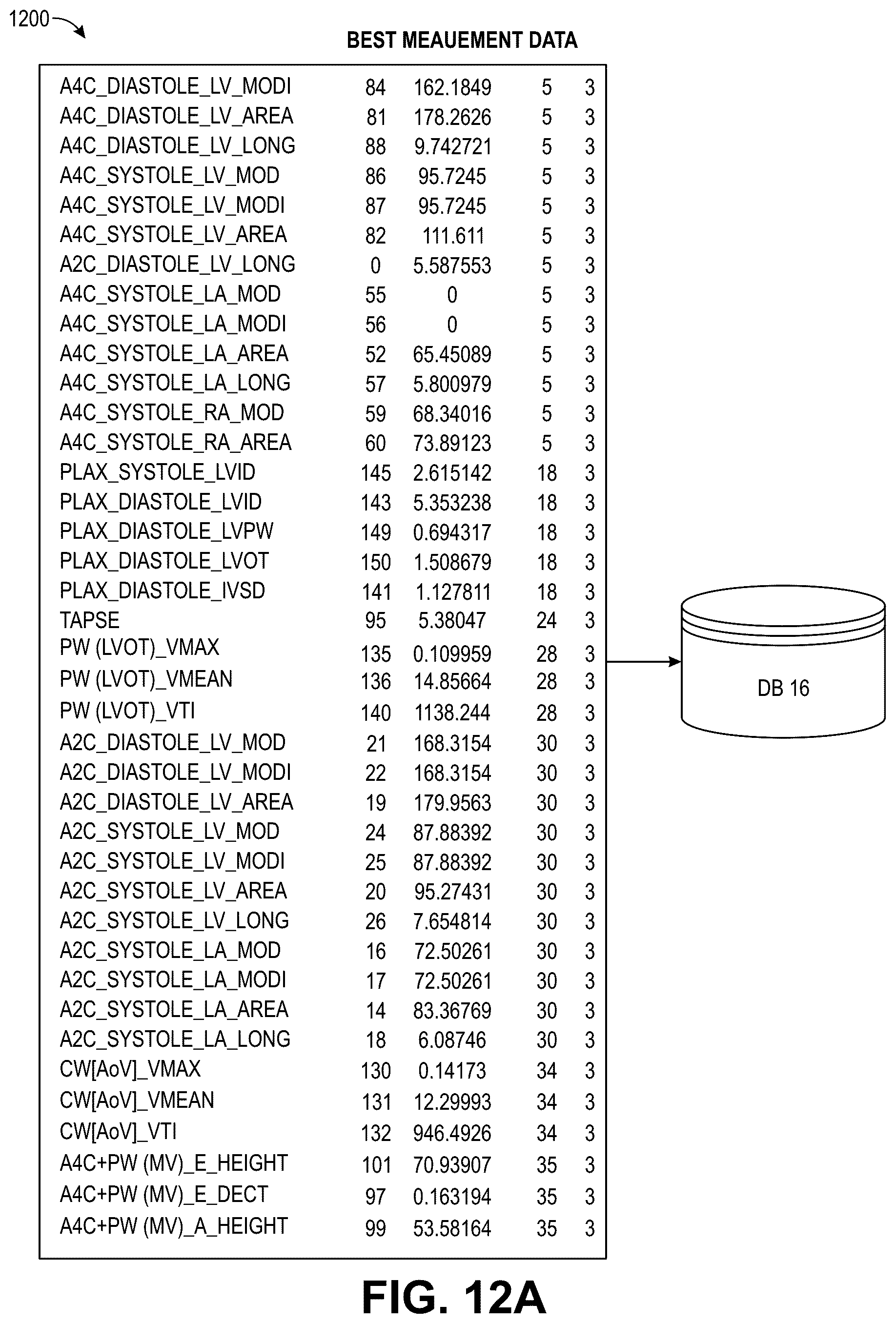 Patent US12322100 Figure 17 – Automatic clinical workflow that recognizes and analyzes 2D and doppler modality echocardiogram images for automated cardiac measurements and grading of aortic stenosis severity