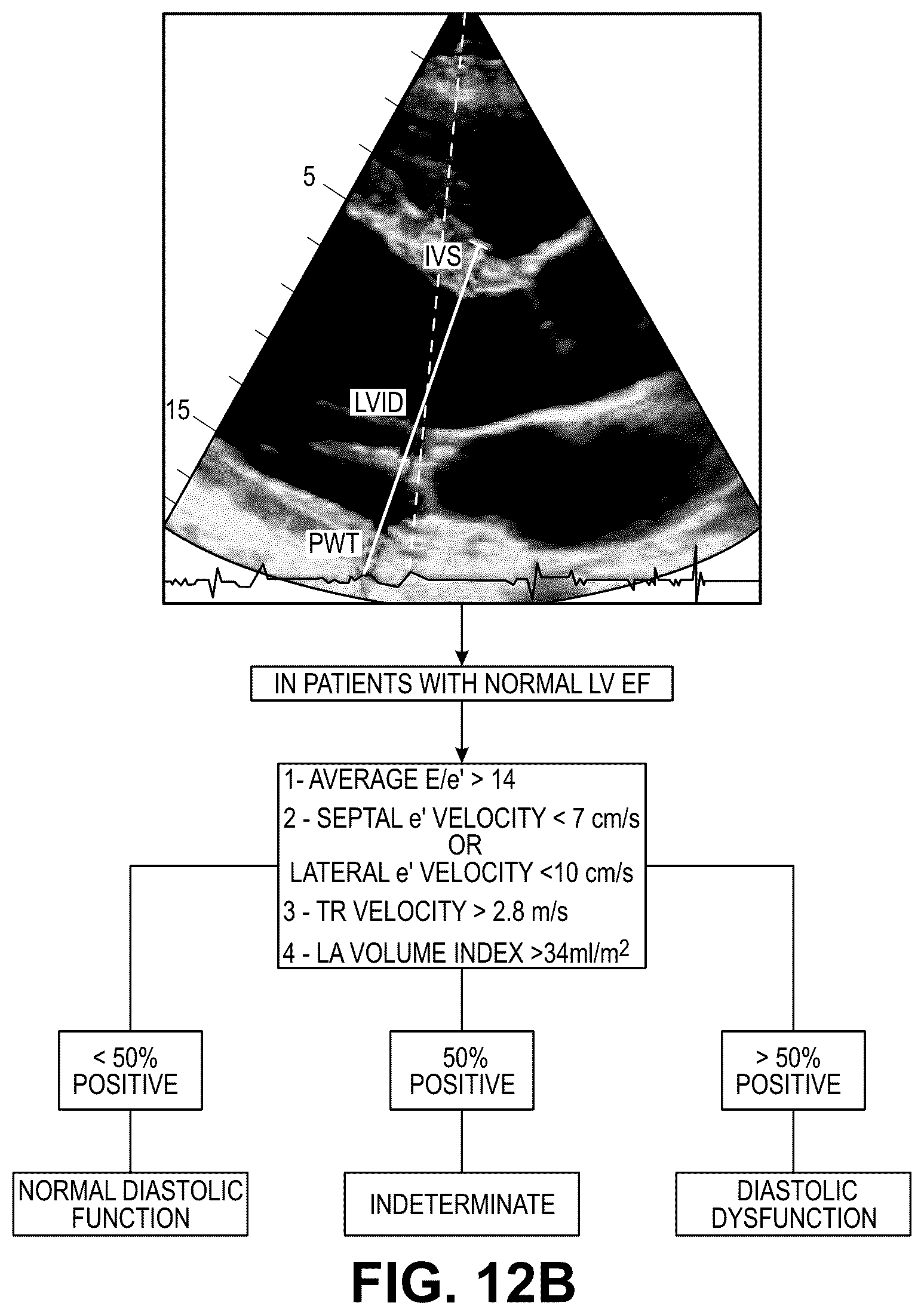 Patent US12322100 Figure 18 – Automatic clinical workflow that recognizes and analyzes 2D and doppler modality echocardiogram images for automated cardiac measurements and grading of aortic stenosis severity