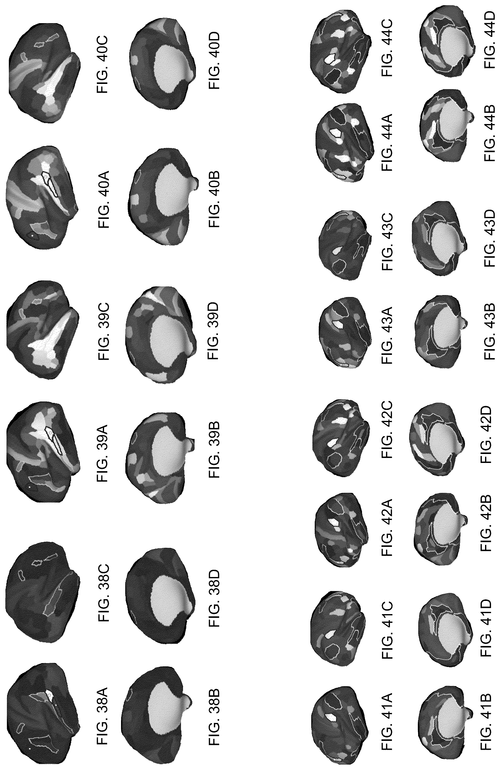 Patent US12322102 Figure 8 – Systems and methods for whole-brain circuit- based neurostimulation to treat brain disorders