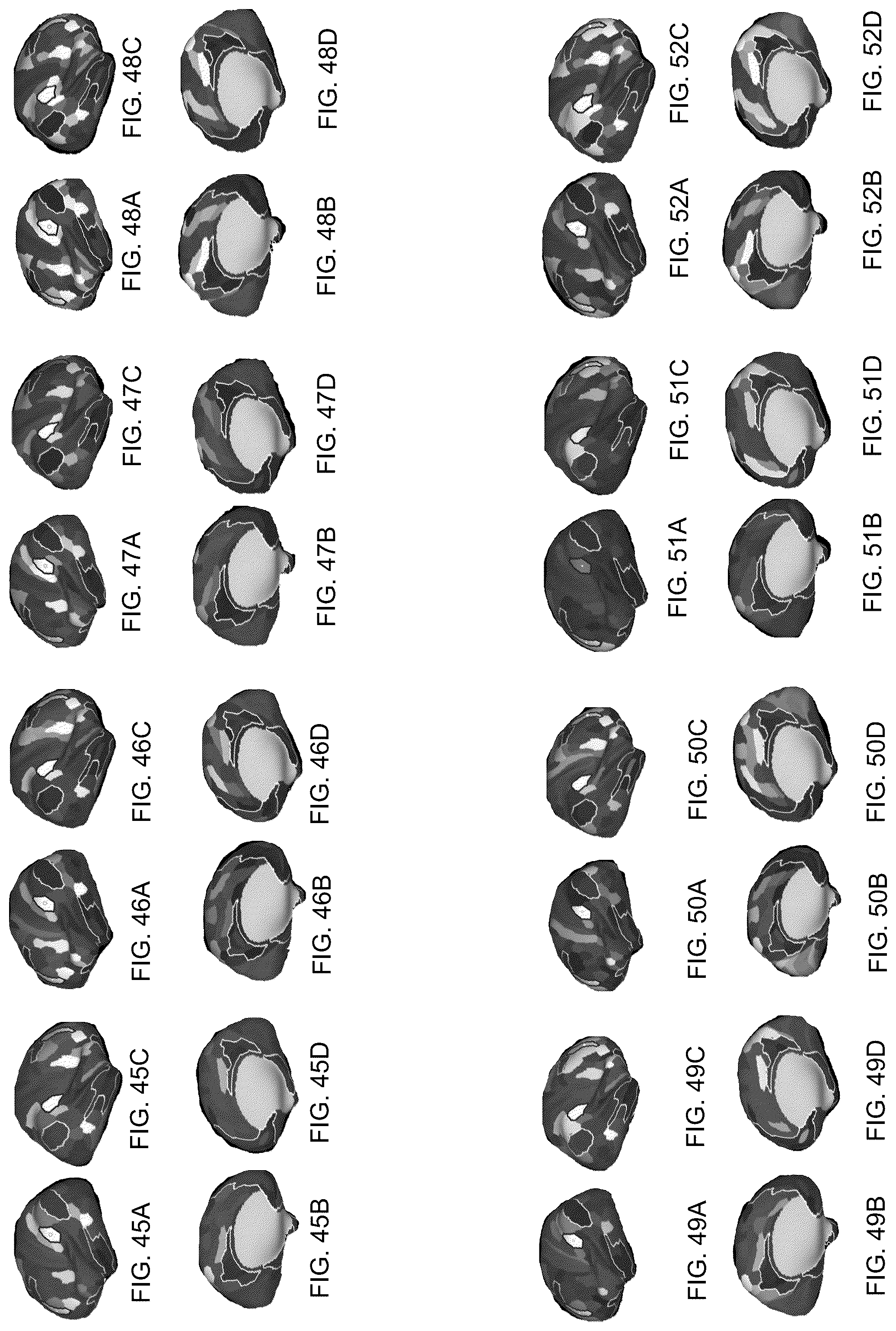 Patent US12322102 Figure 9 – Systems and methods for whole-brain circuit- based neurostimulation to treat brain disorders