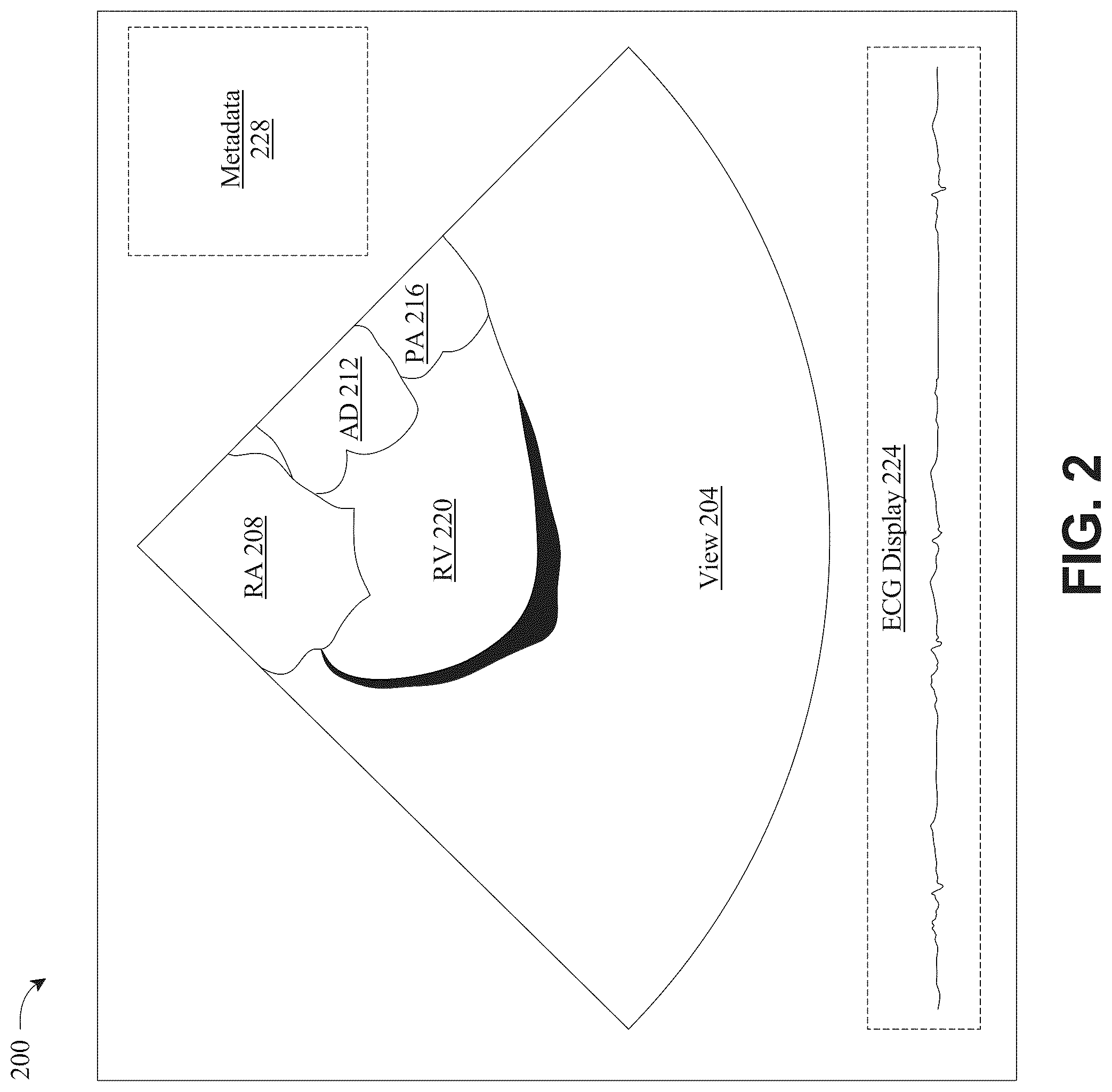 Patent US12322104 Figure 2 – Apparatus and methods for generating a three-dimensional (3D) model of cardiac anatomy via machine-learning